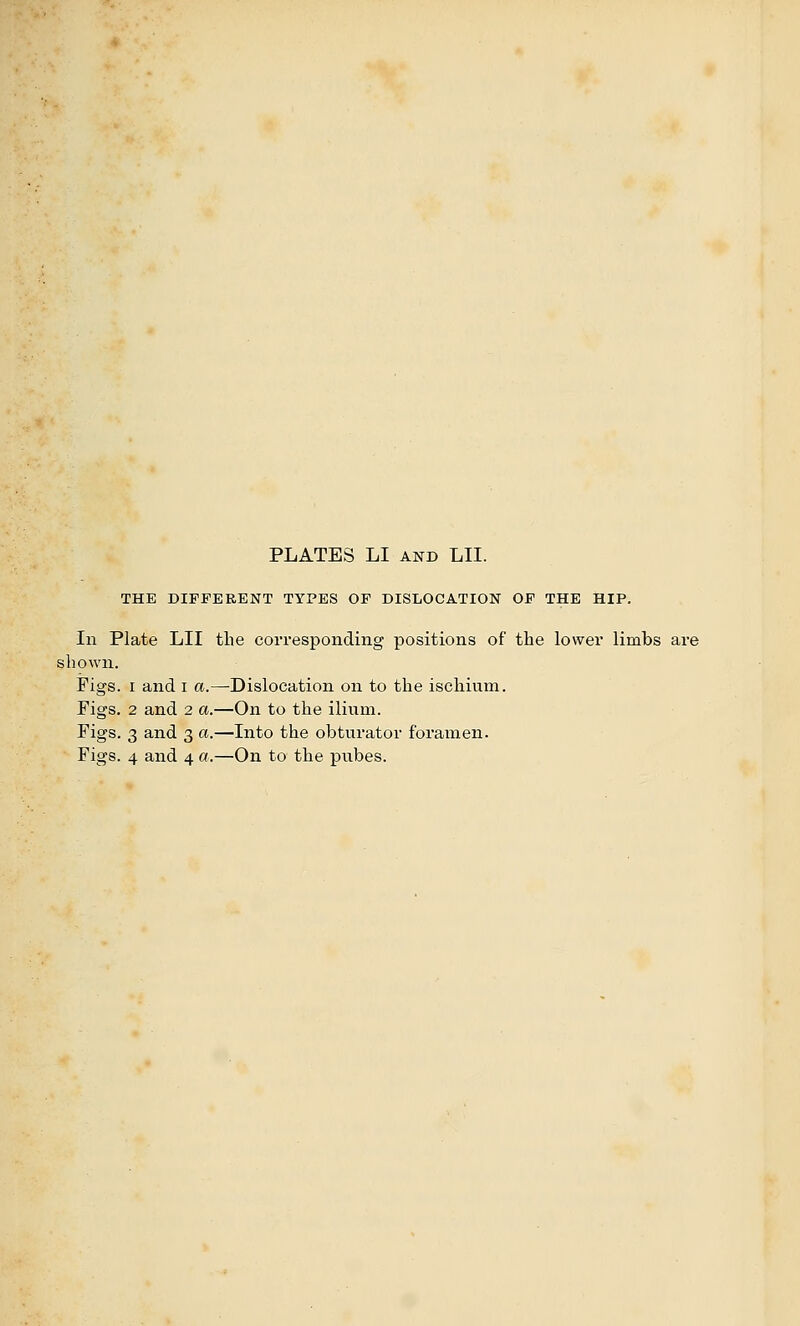 PLATES LI AND LH. THE DIFFERENT TYPES OP DISLOCATION OF THE HIP. In Plate LII tlie corresponding positions of the lower limbs are shown. Figs. I and i a.—Dislocation on to the ischium. Pigs. 2 and 2 a.—On to the ilium. Figs. 3 and 3 a.—Into the obturator foramen. Figs. 4 and 4 a.—On to the pubes.