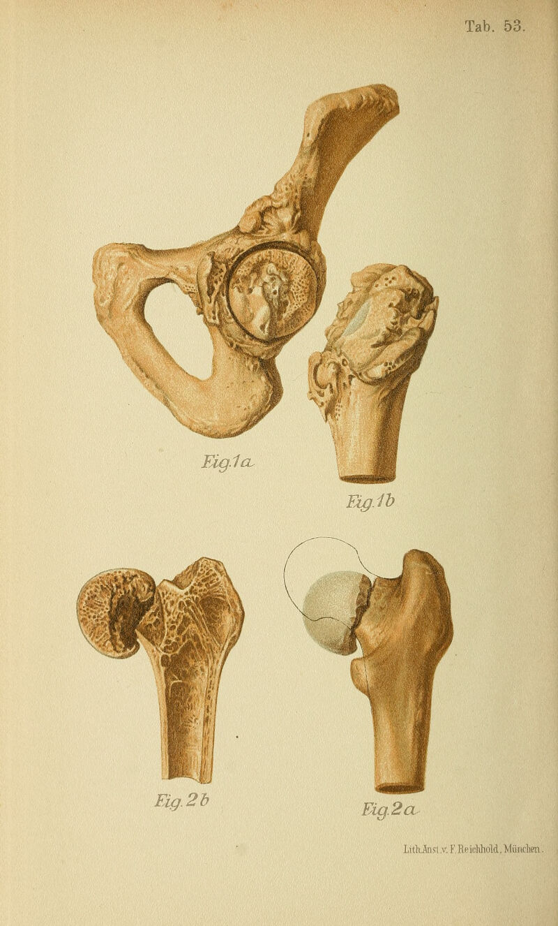 Ei^.lb Pig. 2 a LitkAnsi v. V Reinhhold, l^liiiicltm.