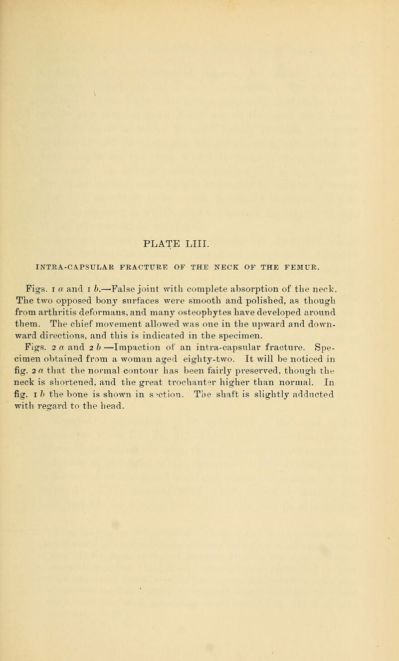 INTRA-CAPSULAR FRACTURE OF THE NECK OF THE FEMUR. Figs. I a and i h.—False joint witli complete absorption of the neck. The two opposed bony snrfaces were smooth and polished, as though from arthritis deformans, and many osteophytes have developed around them. The chief movement allowed was one in the upward and down- ward directions, and this is indicated in the specimen. Figs. 2rt and 26—Impaction of an intra-capsular fractvire. Spe- cimen obtained from a woman aged eighty-two. It will be noticed in fig. 2rt that the normal contour has been fairly preserved, though the neck is sboi'tened, and the great trochanter higher than normal. In fig. I h tlie bone is shown in section. The shaft is slightly adducted with resrard to the head.
