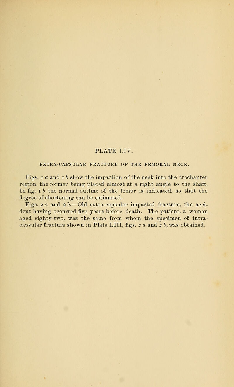 EXTRA-CAPSULAE. FRACTUKE OF THE FEMORAL NECK. Figs. I a and i h sliow tlie impaction of the neck into tlie trochanter region, the former being placed almost at a right angle to tlie shaft. In fig. I h the normal outline of the femur is indicated, so that the degree of shortening can be estimated. Figs. 2 a and 2 h.—Old estra-capsular impacted fracture, the acci- dent having occurred five years before death. The patient, a woman aged eighty-two, was the same from whom tlie specimen of intra- capsular fracture sbown in Plate LIII, figs. 2 a and 2 h, was obtained.