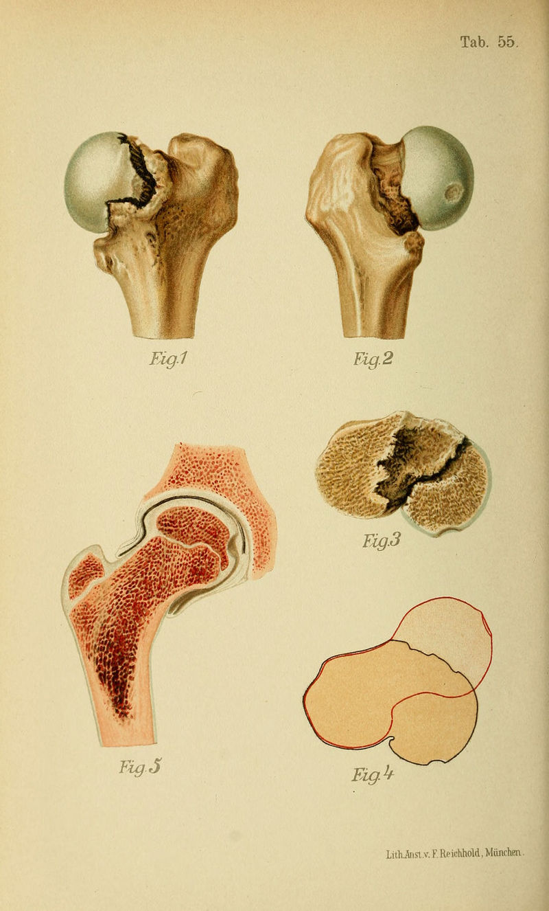 Ei^.1 Ei^.2 '■'i-y^:. FigJ LlthJnsl.v. F. Reichhöld, Münchea.