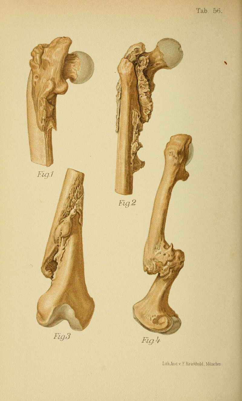 f i^ Eig.3 Lit!i..^tb1 ,v. F, Hcii'lilioM, Münr.hPii,