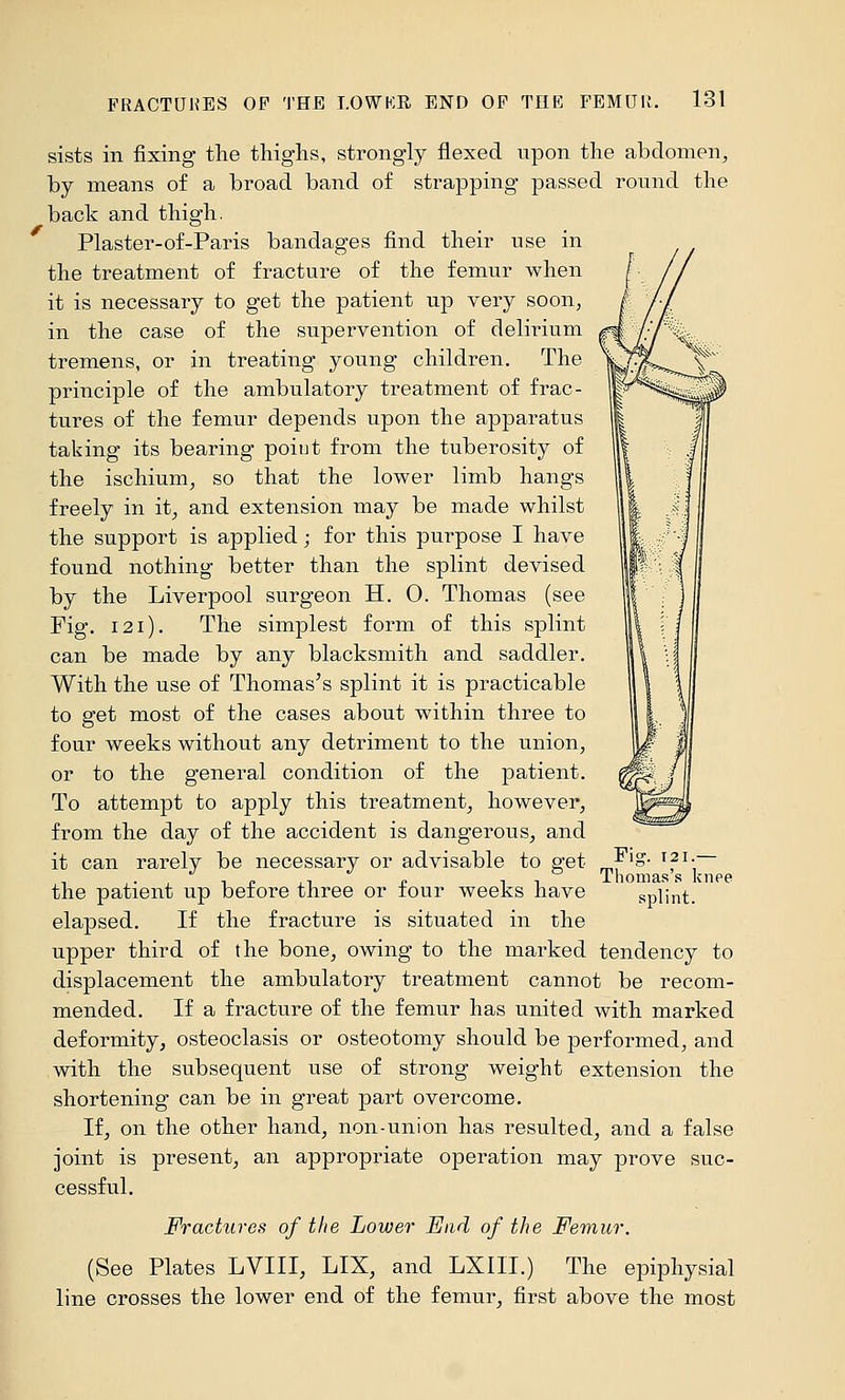 sists in fixing the thighs, strongly flexed upon the abdomen^ by means of a broad band of strapping passed round the back and thigh. Plaster-of-Paris bandages find their use in the treatment of fracture of the femur when it is necessary to get the patient up very soon^ in the case of the supervention of delirium tremens, or in treating young children. The principle of the ambulatory treatment of frac- tures of the femur depends upon the apparatus taking its bearing poiut from the tuberosity of the ischium, so that the lower limb hangs freely in it, and extension may be made whilst the support is applied; for this purpose I have found nothing better than the splint devised by the Liverpool surgeon H. 0. Thomas (see Fig. I2i). The simplest form of this splint can be made by any blacksmith and saddler. With the use of Thomas's splint it is practicable to get most of the cases about within three to four weeks without any detriment to the union, or to the general condition of the patient. To attempt to apply this treatment, however, from the day of the accident is dangerous, and it can rarely be necessary or advisable to get „^'^' 'f^' the patient up before three or four weeks have splint, elapsed. If the fracture is situated in the upper third of the bone, owing to the marked tendency to displacement the ambulatory treatment cannot be recom- mended. If a fracture of the femur has united with marked deformity, osteoclasis or osteotomy should be performed, and with the subsequent use of strong weight extension the shortening can be in great part overcome. If, on the other hand, non-union has resulted, and a false joint is present, an appropriate operation may prove suc- cessful. Fractures of the Lower End of the Femur. (See Plates LVIII, LIX, and LXIII.) The epiphysial line crosses the lower end of the femur, first above the most