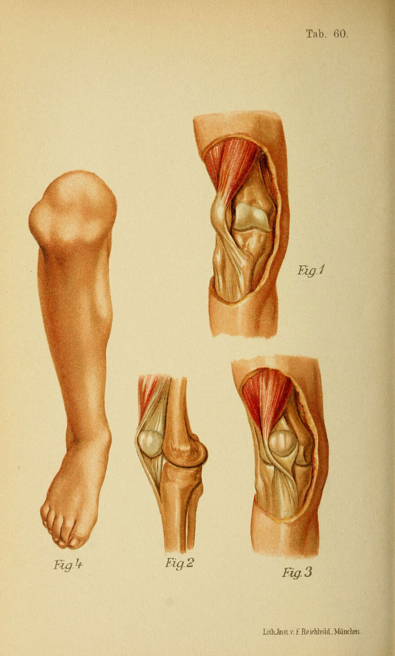 Fig.k Fig.3 lithJnsi v. f. ReifiUioM, München.