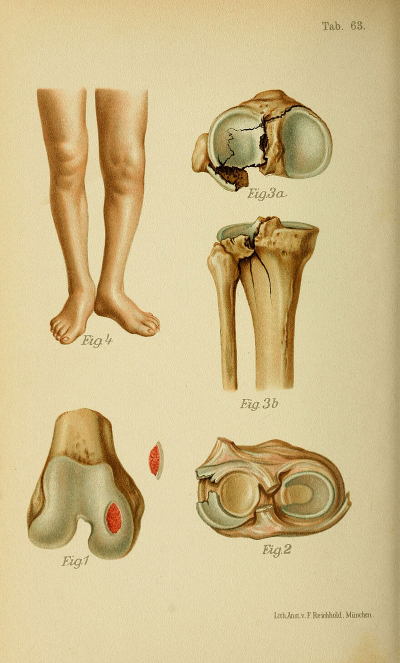 HäXI-ÖOL^ Fig. 3b Fig.1 üAg.k LithAisl.v. F. Reiolihöld, München