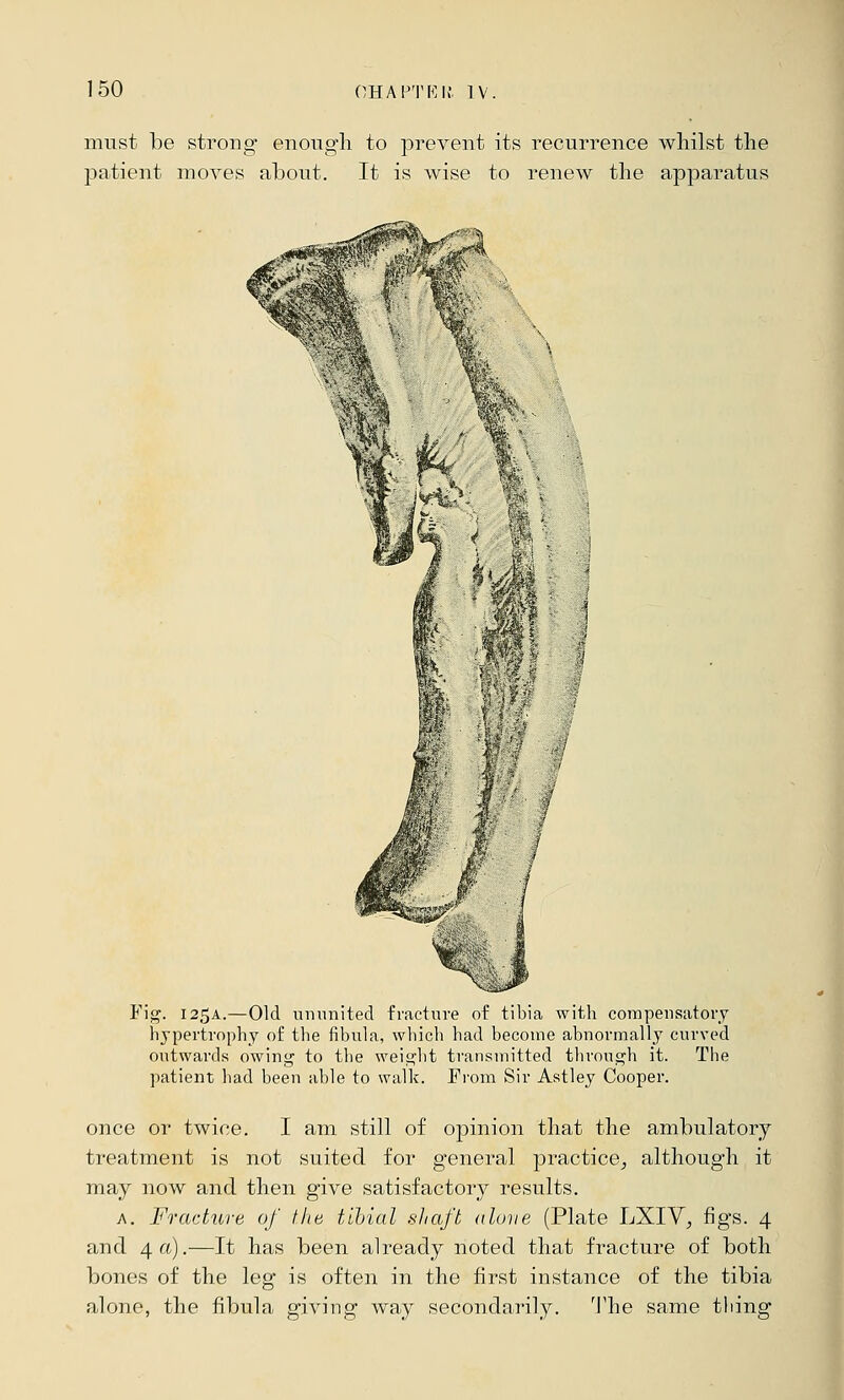 must be strong enough to prevent its recurrence whilst the patient moves about. It is wise to renew the apparatus Fi<?. 125A.—Old unnnited fracture of tibia with compensatory hypertrophy of tlie fibula, which had become abnormally curved outwards owing to the weight transmitted tlirough it. The patient had been able to walk. Ti'om Sir Astley Cooper. once or twice. I am still of opinion that the ambulatory treatment is not suited for general practice^ although it may now and then give satisfactory results. A. Fracture of the tibial shaft aluve (Plate LXIV^, figs. 4 and 4 a).—It has been already noted that fracture of both bones of the leg is often in the first instance of the tibia alone, the fibula giving way secondarily. The same thing