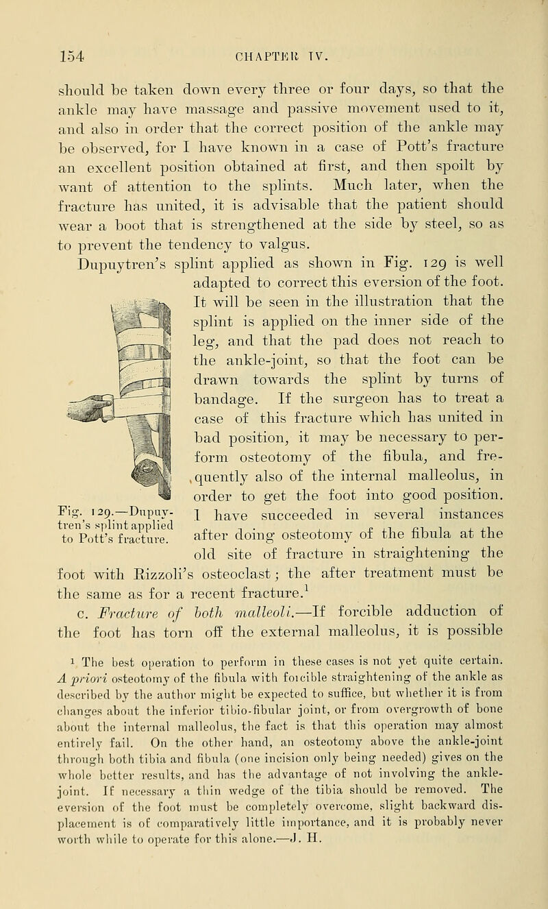 should be taken down every three or four days, so that the ankle may have massage and passive movement used to it, and also in order that the correct position of the ankle may be observed, for I have known in a case of Pott's fracture an excellent position obtained at first, and then spoilt by want of attention to the splints. Much later, when the fracture has united, it is advisable that the patient should wear a boot that is strengthened at the side by steel, so as to prevent the tendency to valgus. Dupuytren's splint applied as shown in Fig. 129 is well adapted to correct this eversion of the foot. It will be seen in the illustration that the splint is applied on the inner side of the leg, and that the pad does not reach to the ankle-joint, so that the foot can be drawn towards the splint by turns of bandage. If the surgeon has to treat a case of this fracture which has united in bad position, it may be necessary to per- form osteotomy of the fibula, and fre- .quently also of the internal malleolus, in order to get the foot into good position. I have succeeded in several instances after doing osteotomy of the fibula at the old site of fracture in straightening the foot with Eizzoli's osteoclast; the after treatment must be the same as for a recent fracture.^ c. Fracture of both vialleoli.—If forcible adduction of the foot has torn off the external malleolus, it is possible V The best operation to perform in these cases is not yet quite certain. A priori osteotomy of the fibula with foicible straightening of the ankle as described by the author might be expected to suffice, but whether it is from changes about the inferior tibio-fibular joint, or from overgrowth of bone about the internal malleolus, the fact is that this operation may almost entirely fail. On the other hand, an osteotomy above the ankle-joint through both tibia and fibula (one incision only being needed) gives on the whole better results, and has the advantage of not involving the ankle- joint. If necessary a thin wedge of the tibia should be removed. The eversion of the foot must be completely overcome, slight backward dis- placement is of comparatively little importance, and it is probably never worth while to operate for this alone.—.1. H. Fig. 129.—Dupuy- tren's s))lint applied to Pott's fracture.