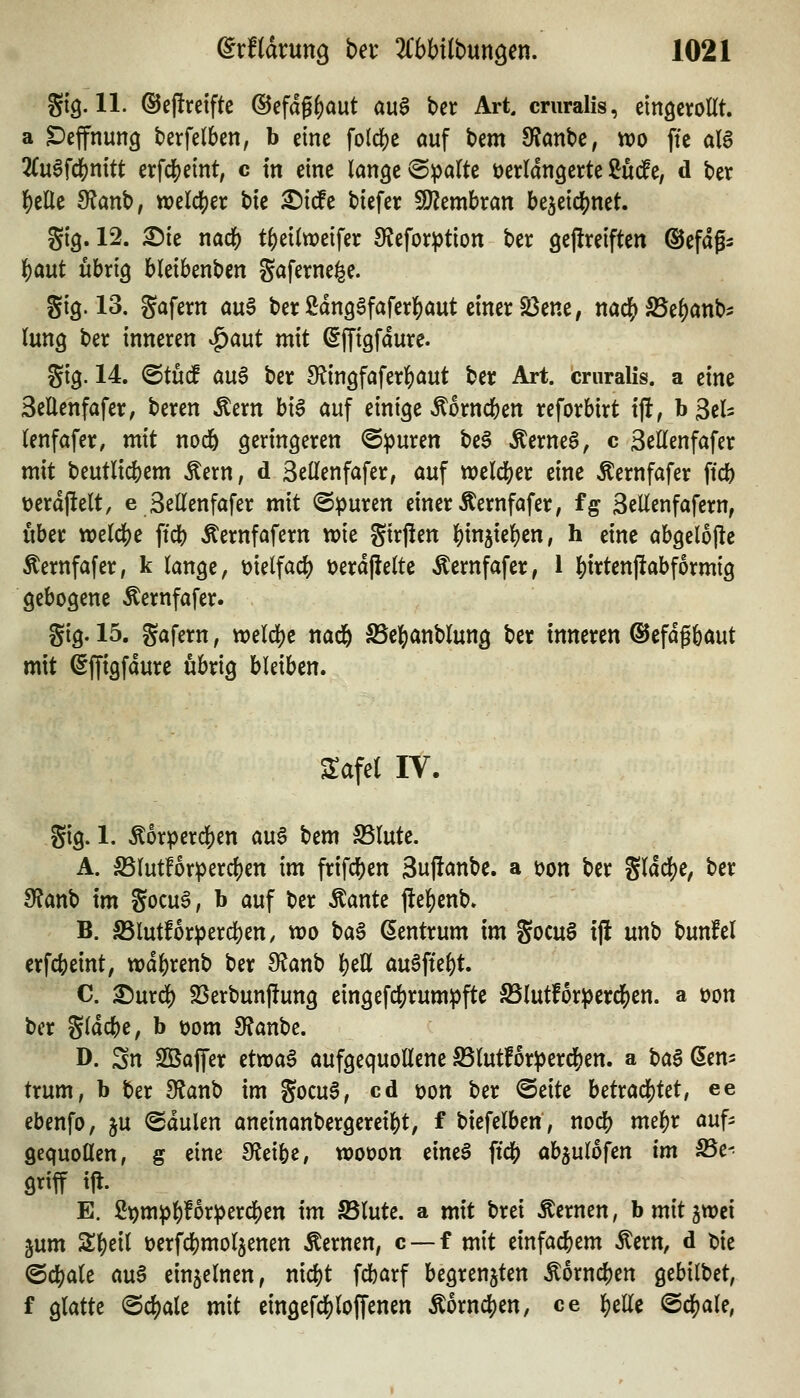 gtg. 11. ©ejiretfte ©efdg^aut an§ bcr Art cruralis, eingerollt. a ^Defnun^ betfelben, b eine fo(d[)c auf Um 9?anbc, wo fic al6 2(uafdS)nitt erfdS)emt; c in eine lange @pa(te verlängerte ^ude, d ber l^elle Sf^anb, tt)elclj)er bte X)xdt biefer 9}?embran hqti(i)mt. gig. 12. £)ie nacl() t^eilweifer 9?efor^tion ber gejlreiften @efdg- i)ant übrig bleibenben gaferne^e. gig. 13. gafern a\x§ ber ßdnggfaferl^aut einer 23ene, nad^^e^anb^ lung ber inneren ^aut mit (SjTigfdure. gtg. 14. ^tM aü$ ber 3^in9faferlE)<^ut ber Art. Icmralis. a eine SeÜenfafer, beren Äern bi6 auf einige <^orncben reforbirt tft, b gels lenfafer, mit nod& geringeren @^uren beS ÄerneS, c 3ellenfafer mit beutlt(iem Äern, d 3ellenfafer, auf weld^er eine Äernfafer ftc& Dcrdftelt, e Bellenfafer mit (Spuren einer Äernfafer, fg Sellenfafcrn, über wzid)e ftcb Äernfafern tvie girjien l()injiel)cn, h eine abgelojle ^ernfafer, k lange, vielfach) tjerdjielte Äernfafer, 1 l[)irtenjtabf6rmig gebogene Äernfafer. gig. 15. gafern, wdd)t nac6 SSel^anblung ber inneren ®efdgbaut mit Sffigfdure übrig bleiben. Safel IV. gig. 1. ^orpercben au6 tcm S5lute. A. S3lutforpercf)en im frifcl[)en 3u|ianbc. a von ber gldd()e, ber dlant im gocuS, b auf ber Äante jle^enb» B. S5lutf6rperd)en, wo \ia$ Zentrum im gocuS tj! unb bunfel crfcbeint, wdbrenb ber 9?anb l^eH auSfte^t. C. ^urd^ §ßerbun|!ung eingefc^rumpfte S5lutforpercl[)en. a von ber gldcbe, b t)om 9?anbc. D. Sn Sßaffer tttoa$ aufgequollene ^lutfor^erd^en. a ha^ Zen- trum, b ber SRanb im gocu6, cd von ber <5eite betracl()tet, ee ebenfo, ju <Sdulen aneinanbergerei^t, f biefelben, nocb me^r auf- gequollen, g eine SfJeibe, woüon eine§ ficl[) abjulofen im be- griff ifl. E. ß^m^f)!or^)ercl^en im Slute. a mit brei fernen, bmitgwci gum S;^eil üerfdjmoljenen fernen, c —f mit einfachem ^ern, d bie ^ä)ak aus einzelnen, nic^t fcbarf begrenzten ^orncben gebilbet, f glatte Schale mit eingefcl)loffenen ^knä)tn, ce ]()elle ®ä)aU,
