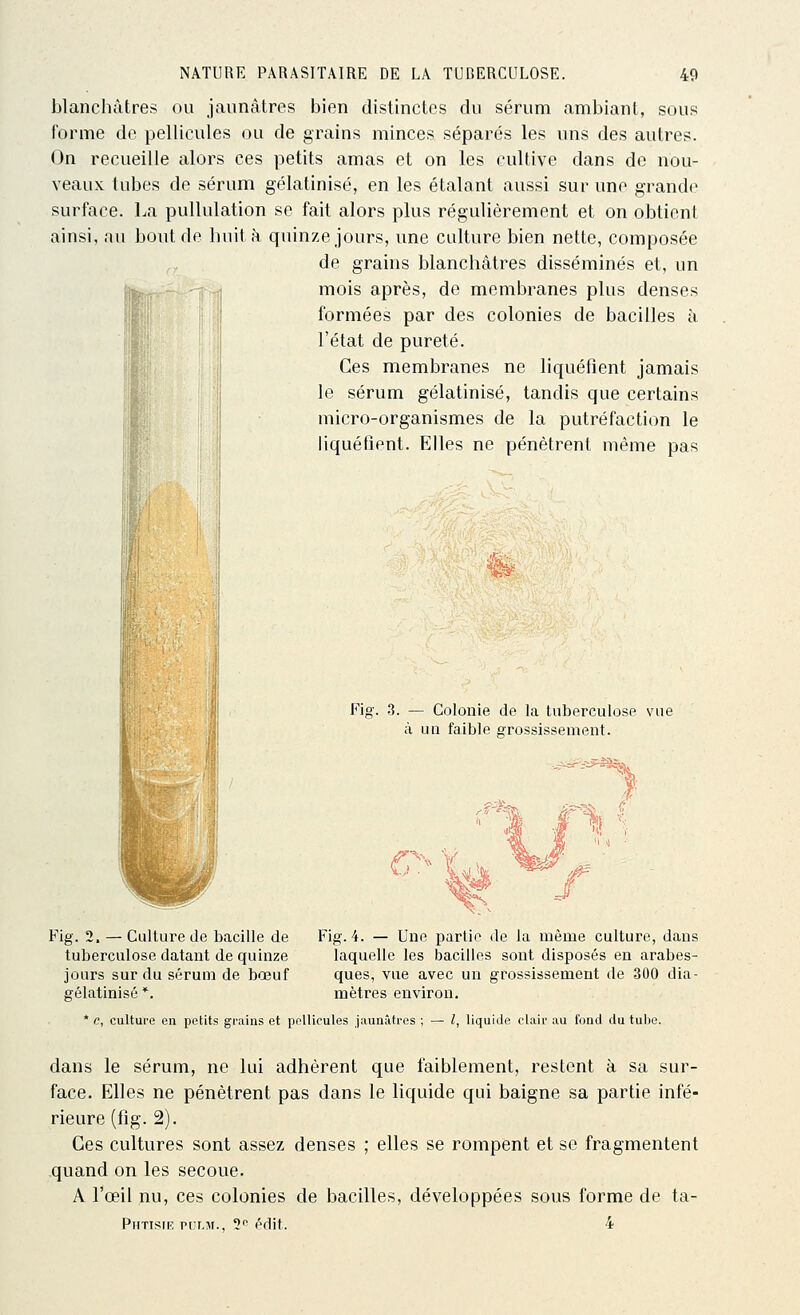 II blanchâtres ou jaunâtres bien distinctes du sérum ambiant, sous forme de pellicules ou de grains minces séparés les uns des autres. On recueille alors ces petits amas et on les cultive dans de nou- veaux tubes de sérum gélatinisé, en les étalant aussi sur une grande surface. La puUulation se fait alors plus régulièrement et on obtient ainsi, nu bout de huit à quinze jours, une culture bien nette, composée de grains blanchâtres disséminés et, un mois après, de membranes plus denses formées par des colonies de bacilles à l'état de pureté. Ces membranes ne liquéfient jamais le sérum gélatinisé, tandis que certains micro-organismes de la putréfaction le liquéfient. Elles ne pénètrent même pas # Fig. 3. — Colonie de la tuberculose vue à un faible grossissement. c>Ia ^ Fig. 2. — Culture de bacille de Fig. 4. — Une partie de la même culture, dans tuberculose datant de quinze laquelle les bacilles sont disposés en arabes- jours sur du sérum de bœuf ques, vue avec un grossissement de 300 dia- gélatinisé*. mètres environ. * c, culture en petits grains et pellicules jaunâtres ; — /, liquide clair au fond du tulie. dans le sérum, ne lui adhèrent que faiblement, restent à sa sur- face. Elles ne pénètrent pas dans le liquide qui baigne sa partie infé- rieure (fig. 2). Ces cultures sont assez denses ; elles se rompent et se fragmentent .quand on les secoue. A l'œil nu, ces colonies de bacilles, développées sous forme de ta- Phtisie pulm., 5*^ édit. 4