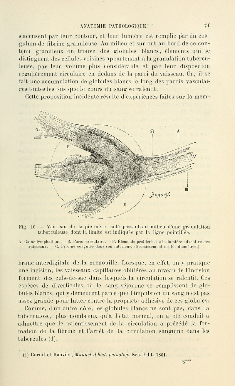 s'accusent par leur contour, et leur lumière est remplie par un coa- gulum de fibrine granuleuse. Au milieu et surtout au bord de ce con- tenu granuleux on trouve des globules blancs, éléments qui se distinguent des cellules voisines appartenant à la granulation tubercu- leuse, par leur volume plus considérable et par leur disposition régulièrement circulaire en dedans de la paroi du vaisseau. Or, il se fait une accumulation de globules blancs le long des parois vasculai- res toutes les fois que le cours du sang se ralentit. Cette proposition incidente résulte d'expériences faites sur la mem- FiK. 10. — Vaisseau de la pie-mère isolé passant au milieu d'une granulation tuberculeuse dont la limite est indiquée par la ligne pointillée. A. Gaine lymphatique. — B. Paroi vasculaire. — F. Élémeuts prolifères de la lumière adventive des vaisseaux. — G. Fibrine coagulée dans son intérieur. (Grossissement de 100 diamètres.) brane interdigitale de la grenouille. Lorsque, en effet, on y pratique une incision, les vaisseaux capillaires oblitérés au niveau de l'incision forment des. culs-de-sac dans lesquels la circulation se ralentit. Ces espèces de diverticules où le sang séjourne se remplissent de glo- bules blancs, qui y demeurent parce que l'impulsion du sang n'est pas assez grande pour lutter contre la propriété adhésive de ces globules. Comme, d'un autre côté, les globules blancs ne sont pas, dans la tuberculose, plus nombreux qu'à l'état normal, on a été conduit à admettre que le ralentissement de la circulation a précédé la for-, mation de la fibrine et l'arrêt de la circulation sanguine dans les tubercules (1).