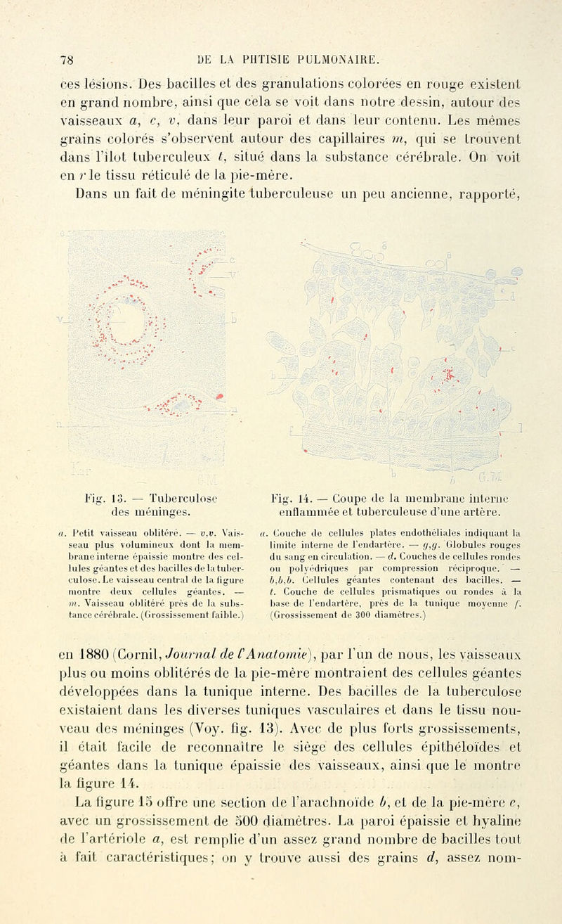 ces lésions. Des bacilles et des granulations colorées en rouge existent en grand nombre, ainsi que cela se voit dans notre dessin, autour des vaisseaux a, c, v, dans leur paroi et dans leur contenu. Les mêmes grains colorés s'observent autour des capillaires m, qui se trouvent dans l'ilot tuberculeux t, situé dans la substance cérébrale. On voit en rie tissu réticulé de la pie-mère. Dans un fait de méningite tuberculeuse un peu ancienne, rapporté, Fil 13. des — Tuberculose méninûes. . Petit viiisseau oblitéré. — v,v. Vais- seau plus volumineux dont la mem- brane interne épaissie montre des cel- lules géantes et des bacilles de la tuber- culose. Le vaisseau central de la figure montre deux cellules géantes. — m. Vaisseau oblitéré près de la subs- tance cérébrale. (Grossissement faible.) Fig. 14. — Coupe de la membrane interne enflammée et tuberculeuse d'une artère. . Couche de cellules plates endothéliales indiquant la limite interne de Tendartère. — rj,y. Globules rouges du sang en circulation. — d. Couches de cellules rondos ou polyédriques par compression réciproque. — b,b,b. Cellules géantes contenant des bacilles. — t. Couche de cellules prismatiques ou rondes à la base de l'endartère, près de la tunique moyenne /'. (Grossissement de 300 diamètres.) en 1880 (Cornil, Journal de CAnatomie), par l'un de nous, les vaisseaux plus ou moins oblitérés de la pie-mère montraient des cellules géantes développées dans la tunique interne. Des bacilles de la tuberculose existaient dans les diverses tuniques vasculaires et dans le tissu nou- veau des méninges (Voy. fig. 13). Avec de plus forts grossissements, il était facile de reconnaître le siège des cellules épithéloïdes et géantes dans la tunique épaissie des vaisseaux, ainsi que le montre la figure 14. La ligure 15 offre une section de l'arachnoïde h, et de la pie-mère c, avec un grossissement de oOO diamètres. La paroi épaissie et hyaline de l'artériole a, est remplie d'un assez grand nombre de bacilles tout à fait caractéristiques; (^n y trouve aussi des grains d, assez nom-