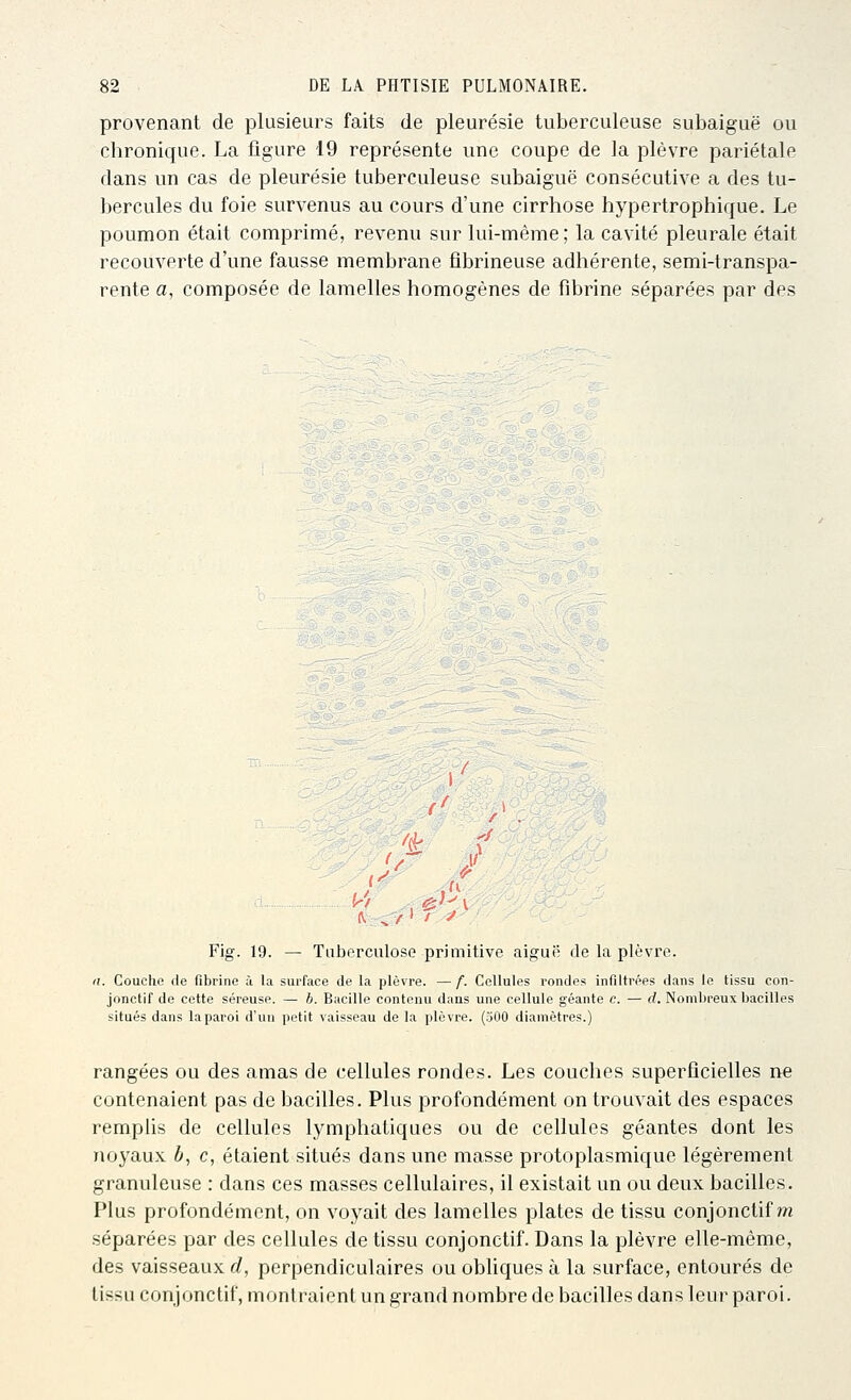 provenant de plusieurs faits de pleurésie tuberculeuse subaiguë ou chronique. La figure 19 représente une coupe de la plèvre pariétale dans un cas de pleurésie tuberculeuse subaiguë consécutive a des tu- bercules du foie survenus au cours d'une cirrhose hypertrophique. Le poumon était comprimé, revenu sur lui-même; la cavité pleurale était recouverte d'une fausse membrane fîbrineuse adhérente, semi-transpa- rente a, composée de lamelles homogènes de fibrine séparées par des , / / / Fig. 19. — Tnberculoso primitive aiguë de la plèvre. a. Couche de fibrine à la surface de la plèvre. — f. Cellules rondes infiltrées dans le tissu con- jonctif de cette séreuse. — h. Bacille contenu dans une cellule géante c. — d. Nombreux bacilles situés dans la paroi d'un petit vaisseau de la plèvre. (300 diamètres.) rangées ou des amas de cellules rondes. Les couches superficielles n« contenaient pas de bacilles. Plus profondément on trouvait des espaces rempUs de cellules lymphatiques ou de cellules géantes dont les noyaux 6, c, étaient situés dans une masse protoplasmique légèrement granuleuse : dans ces masses cellulaires, il existait un ou deux bacilles. Plus profondément, on voyait des lamelles plates de tissu conjonctif m séparées par des cellules de tissu conjonctif. Dans la plèvre elle-même, des vaisseaux d, perpendiculaires ou obliques à la surface, entourés de tissu conjonctif, montraient un grand nombre de bacilles dans leur paroi.