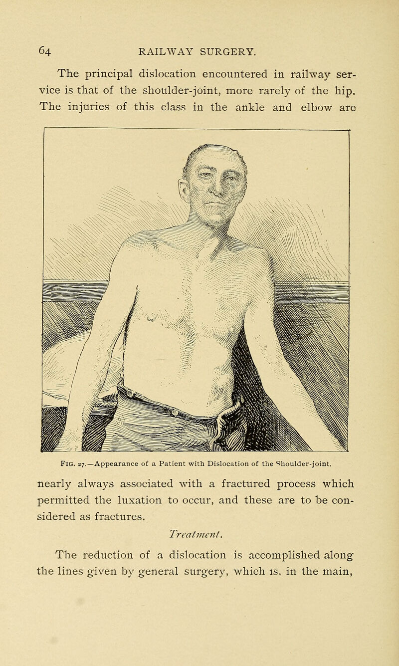 The principal dislocation encountered in railway ser- vice is that of the shoulder-joint, more rarely of the hip. The injuries of this class in the ankle and elbow are Fig. 27.—Appearance of a Patient with Dislocation of the Shoulder-joint. nearly always associated with a fractured process which permitted the luxation to occur, and these are to be con- sidered as fractures. Treatment. The reduction of a dislocation is accomplished along the lines given by general surgery, which is, in the main,