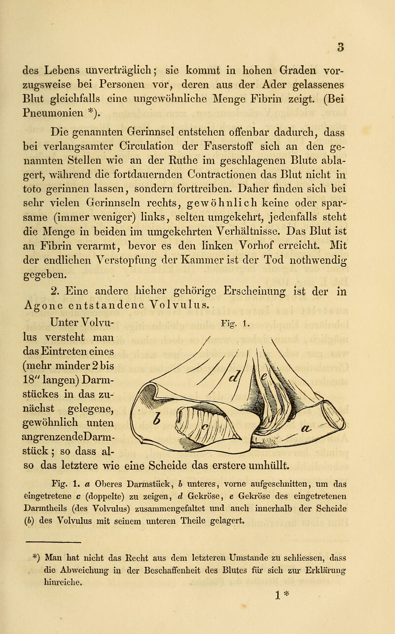 des Lebens imverträglicli; sie kommt In hohen Graden vor- zugsweise bei Personen vor, deren aus der Ader gelassenes Bkit gleichfalls eine ungewöhnliche Menge Fibrin zeigt. (Bei Pneumonien *). Die genannten Gerinnsel entstehen offenbar dadurch, dass bei verlangsamter Circulation der Faserstoff sich an den ge- nannten Stellen wie an der Ruthe im geschlagenen Blute abla- gert, während die fortdauernden Contractionen das Blut nicht in toto gerinnen lassen, sondern forttreiben. Daher finden sich bei sehr vielen Gerinnseln rechts, gewöhnlich keine oder spar- same (immer weniger) links, selten umgekehrt, jedenfalls steht die Menge in beiden im umgekehrten Verhältnisse. Das Blut ist an Fibrin verarmt, bevor es den linken Vorhof erreicht. Mit der endlichen Verstopfung der Kammer ist der Tod nothwendig gegeben. 2. Eine andere hieher gehörige Erscheinung ist der in Agone entstandene Volvulus. Unter Volvu- lus versteht man das Eintreten eines (mehr minder 2 bis 18 langen) Darm- stückes in das zu- nächst gelegene, gewöhnlich unten angrenzendeDarm- stück; so dass al- so das letztere wie eine Scheide das erstere umhüllt. Fig. 1. a Oberes Darmstück, h imteres, vorne aufgeschnitten, um das eingetretene c (doppelte) zu zeigen, d Gekröse, e Geki-öse des eingetretenen Dai-mtheils (des Volvulus) zusammengefaltet und auch innerhalb der Scheide (6) des Volvulus mit seinem unteren Theile gelagert. Fi'. 1, •=) Man hat nicht das Recht aus dem letzteren Umstände zu schKessen, dass die Abweichimg in der Beschaifenheit des Blutes für sich zur Erklärung him'eiche. 1*