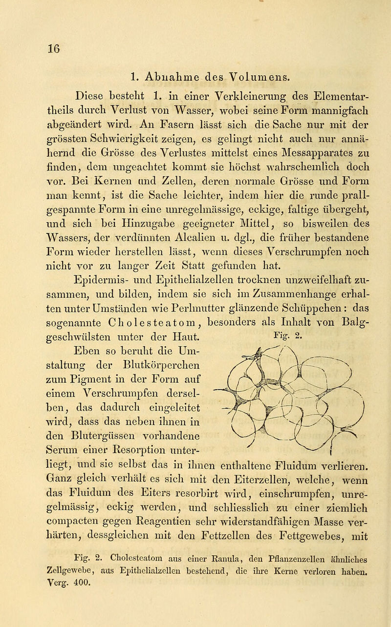 1. Abnahme des Volumens. Diese besteht 1. in einer Verkleinerung des Elementar- theils durch Verlust von Wasser, wobei seine Form mannigfach abgeändert wird. An Fasern lässt sich die Sache nur mit der grössten Schwierigkeit zeigen, es gelingt nicht auch nur annä- hernd die Grösse des Verlustes mittelst eines Messapparates zu finden, dem ungeachtet kommt sie höchst wahrschemlich doch vor. Bei Kernen und Zellen, deren normale Grösse und Form man kennt, ist die Sache leichter, indem hier die runde prall- gespannte Form in eine unregelmässige, eckige, faltige übergeht, und sich bei Hinzugabe geeigneter Mittel, so bisM^eilen des Wassers, der verdünnten Alealien u. dgl., die früher bestandene Form wieder herstellen lässt, wemi dieses Verschrumpfen noch nicht vor zu langer Zeit Statt gefunden hat. Epidermis- und Epithelialzellen trocknen unzweifelhaft zu- sammen, und bilden, indem sie sich im Zusammenhange erhal- ten unter Umständen wie Perlmutter glänzende Schüppchen : das sogenannte Cholesteatom, besonders als Inhalt von Balg- geschwülsten unter der Haut. Eben so beruht die Um- staltung der Blutkörperchen zum Pigment in der Form auf einem Verschrumpfen dersel- ben, das dadurch eingeleitet wird, dass das neben ihnen in den Blutergüssen vorhandene Serum einer Resorption unter- liegt, und sie selbst das in ihnen enthaltene Fluidum verlieren. Ganz gleich verhält es sich mit den Eiterzellen, welche, wenn das Fluidum des Eiters resorbirt wird, einschrumpfen, unre- gelmässig, eckig werden, und schliesslich zu einer ziemlich compacten gegen Reagentien sehr widerstandfähigen Masse ver- härten, dessgleichen mit den Fettzellen des Fettgewebes, mit Fig. 2. Cholesteatom aus einer Kanula, den Pflanzenzellen ähnliches Zellgewebe, aus Epithelialzellen bestehend, die ilire Kerne verloren haben. Verg. 400.