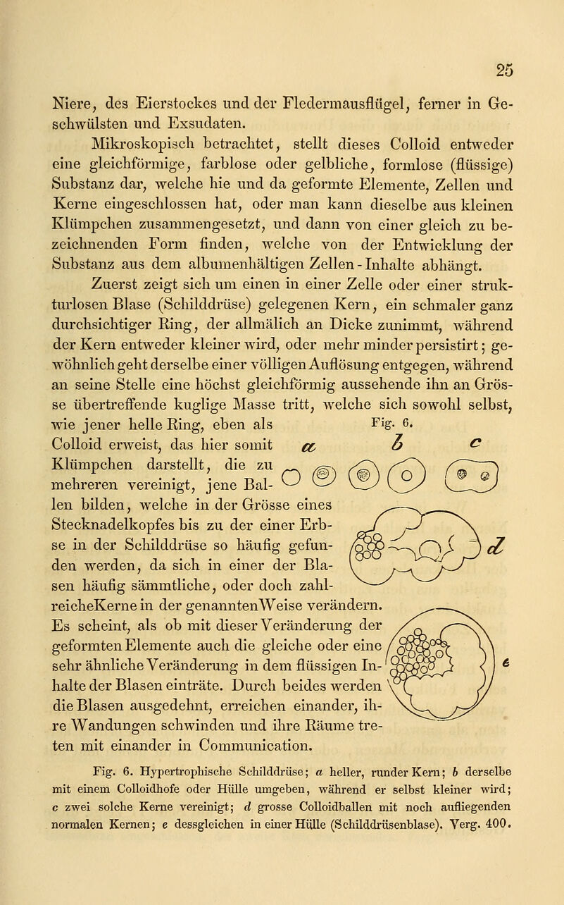 Niere, des Eierstockes und der Flcdermausflügel, ferner in Ge- schwülsten und Exsudaten. Mikroskopisch betrachtet, stellt dieses Colloid entweder eine gleichförmige, farblose oder gelbliche, formlose (flüssige) Substanz dar, welche hie und da geformte Elemente, Zellen und Kerne eingeschlossen hat, oder man kann dieselbe aus kleinen Klümpchen zusammengesetzt, und dann von einer gleich zu be- zeichnenden Form finden, welche von der Entwicklung der Substanz aus dem albumenhältigen Zellen - Inhalte abhängt. Zuerst zeigt sich um einen in einer Zelle oder einer struk- turlosen Blase (Schilddrüse) gelegenen Kern, ein schmaler ganz durchsichtiger Ring, der allmälich an Dicke zunimmt, während der Kern entweder kleiner wird, oder mehr minder persistirt; ge- wöhnlichgeht derselbe einer völligen Auflösung entgegen, während an seine Stelle eine höchst gleichförmig aussehende ihn an Grös- se übertreffende kuglige Masse tritt, welche sich sowohl selbst, yvie jener helle Ring, eben als Fig. Colloid erAveist, das hier somit «5^ Klümpchen darstellt, die zu mehreren vereinigt, jene Bai- ^ len bilden, welche in der Grösse eines Stecknadelkopfes bis zu der einer Erb- se in der Schilddrüse so häufig gefun- den werden, da sich in einer der Bla- sen häufig sämmtliche, oder doch zahl- reicheKerne in der genannten Weise verändern. Es scheint, als ob mit dieser Veränderung der geformten Elemente auch die gleiche oder eine sehr ähnliche Veränderung in dem flüssigen In-' halte der Blasen einträte. Durch beides werden die Blasen ausgedehnt, erreichen einander, ih- re Wandungen schwinden und ihre Räume tre- ten mit einander in Communication. Fig. 6. Hypertrophische Schilddrüse; a heller, runder Kern; b derselbe mit einem CoUoidhofe oder Hülle umgeben, während er selbst kleiner wird; c zwei solche Kerne vereinigt; d grosse Colloidballen mit noch aufliegenden normalen Kernen; e dessgleichen in einer Hülle (Schilddrüsenblase). Verg. 400.