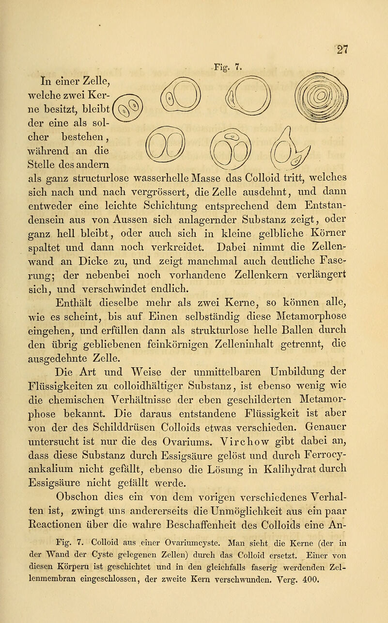 In einer Zelle, welche zwei Ker- ne besitzt, bleibt der eine als sol- cher bestehen, während an die Stelle des andern als ganz structui'lose wasserhelle Masse das Colloid tritt, welches sich nach und nach vergrössert, die Zelle ausdehnt, und dann entweder eine leichte Schichtung entsprechend dem Entstan- densein aus von Aussen sich anlagernder Substanz zeigt, oder ganz hell bleibt, oder auch sich in kleine gelbliche Körner spaltet und dann noch verkreidet. Dabei nimmt die Zellen^ wand an Dicke zu, und zeigt manchmal auch deutliche Fase- rung; der nebenbei noch vorhandene Zellenkern verlängert sich, und verschwindet endlich. Enthält dieselbe mehr als zwei Kerne, so können alle, wie es scheint, bis auf Einen selbständig diese Metamorphose eingehen, und erfüllen dann als strukturlose helle Ballen durch den übrig gebliebenen feinkörnigen Zelleninhalt getrennt, die ausgedehnte Zelle. Die Art und Weise der unmittelbaren Umbildung der Flüssigkeiten zu colloidhältiger Substanz, ist ebenso wenig wie die chemischen Verhältnisse der eben geschilderten Metamor- phose bekannt. Die daraus entstandene Flüssigkeit ist aber von der des Schilddrüsen Colloids etwas verschieden. Genauer untersucht ist nur die des Ovariums. Virchow gibt dabei an, dass diese Substanz durch Essigsäure gelöst und durch Ferrocy- ankalium nicht gefällt, ebenso die Lösung in Kalihydrat durch Essigsäure nicht gefällt werde. Obschon dies ein von dem vorigen verschiedenes Verhal- ten ist, zwingt uns andererseits die Unmöglichkeit aus ein paar Eeactionen über die wahre Beschaffenheit des Colloids eine An- Fig. 7. Colloid aiis einer Ovariumcyste. Man sieht die Kerne (der in der Wand der Cyste gelegenen Zellen) durch das Colloid ersetzt. Einer von diesen KiDrperu ist geschichtet und in den gleichfalls faserig werdenden Zel- lenmembran eingeschlossen, der zweite Kern verschwunden. Verg. 400.
