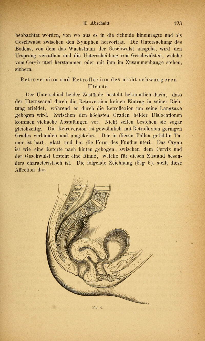 beobachtet worden, von wo aus es in die Scheide hineinragte und als Geschwulst zwischen den Nymphen hervortrat. Die Untersuchung des Bodens, von dem das Wachsthum der Geschwulst ausgeht, wird den Ursprung verrathen und die Unterscheidung von Geschwülsten, welche vom Cervix uteri herstammen oder mit ihm im Zusammenhange stehen, sichern. Retroversion und Retroflexion des nicht schwangeren Uterus. Der Unterschied beider Zustände besteht bekanntlich darin, dass der Uteruscanal durch die Retroversion keinen Eintrag in seiner Rich- tung erleidet, während er durch die Retroflexion um seine Längsaxe gebogen wird. Zwischen den höchsten Graden beider Dislocationen kommen vielfache Abstufungen vor. Nicht selten bestehen sie sogar gleichzeitig. Die Retroversion ist gewöhnlich mit Retroflexion geringen Grades verbunden und umgekehrt. Der in diesen Fällen gefühlte Tu- mor ist hart, glatt und hat die Form des Fundus uteri. Das Organ ist wie eine Retorte nach hinten gebogen; zwischen dem Cervix und der Geschwulst besteht eine Rinne, welche für diesen Zustand beson- ders characteristisch ist. Die folgende Zeichnung (Fig 6). stellt diese Affection dar. Fig. 6.