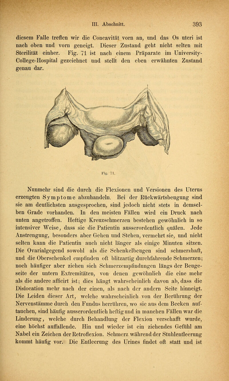 diesem Falle treffen wir die Concavität vorn an, und das Os uteri ist nach oben und vorn geneigt. Dieser Zustand geht nicht selten mit Sterilität einher. Fig. 71 ist nach einem Präparate im University- College-Hospital gezeichnet und stellt den eben erwähnten Zustand genau dar. Fig.-71. Nunmehr sind die durch die Flexionen und Versionen des Uterus erzeugten Symptome abzuhandeln. Bei der Rückwärtsbeugung sind sie am deutlichsten ausgesprochen, sind jedoch nicht stets in demsel- ben Grade vorhanden. In den meisten Fällen wird ein Druck nach unten angetroffen. Heftige Kreuzschmerzen bestehen gewöhnlich in so intensiver Weise, dass sie die Patientin ausserordentlich quälen. Jede Anstrengung, besonders aber Gehen und Stehen, vermehrt sie, und nicht selten kann die Patientin auch nicht länger als einige Minuten sitzen. Die Ovarialgegend sowohl als die Schenkelbeugen sind schmerzhaft, und die Oberschenkel empfinden oft blitzartig durchfahrende Schmerzen; noch häufiger aber ziehen sich Schmerzempfindungen längs der Beuge- seite der untern Extremitäten, von denen gewöhnlich die eine mehr als die andere afficirt ist; dies hängt wahrscheinlich davon ab, dass die Dislocation mehr nach der einen, als nach der andern Seite hinneigt. Die Leiden dieser Art, welche wahrscheinlich von der Berührung der Nervenstämme durch den Fundus herrühren, wo sie aus dem Becken auf- tauchen, sind häufig ausserordentlich heftig und in manchen Fällen war die Linderung, welche durch Behandlung der Flexion verschafft wurde, eine höchst auffallende. Hin und wieder ist ein ziehendes Gefühl am Nabel ein Zeichen derRetroflexion. Schmerz während der Stuhlentleerung kommt häufig vor. Die Entleerung des Urines findet oft statt und ist