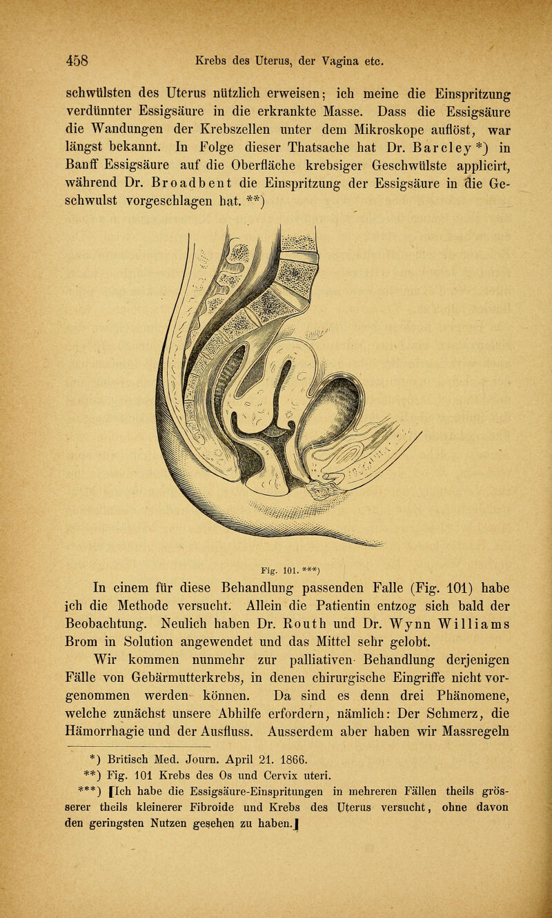 schwülsten des Uterus nützlich erweisen; ich meine die Einspritzung verdünnter Essigsäure in die erkrankte Masse. Dass die Essigsäure die Wandungen der Krebszellen unter dem Mikroskope auflöst, war längst bekannt. In Folge dieser Thatsache hat Dr. Barcley*) in Banff Essigsäure auf die Oberfläche krebsiger Geschwülste applicirt, während Dr. Broadbent die Einspritzung der Essigsäure in die Ge- schwulst vorgeschlagen hat. **) Fig. 101. ***) In einem für diese Behandlung passenden Falle (Fig. 101) habe ich die Methode versucht. Allein die Patientin entzog sich bald der Beobachtung. Neulich haben Dr. Routh und Dr. Wynn Williams Brom in Solution angewendet und das Mittel sehr gelobt. Wir kommen nunmehr zur palliativen Behandlung derjenigen Fälle von Gebärmutterkrebs, in denen chirurgische Eingriffe nicht vor- genommen werden können. Da sind es denn drei Phänomene, welche zunächst unsere Abhilfe erfordern, nämlich: Der Schmerz, die Hämorrhagie und der Ausfluss. Ausserdem aber haben wir Massregeln *) Britisch Med. Journ. April 21. 1866. **) Fig. 101 Krebs des Os und Cervix uteri. ***) [Ich habe die Essigsäure-Einspritungen in mehreren Fällen theils grös- serer theils kleinerer Fibroide und Krebs des Uterus versucht, ohne davon den geringsten Nutzen gesehen zu haben.J