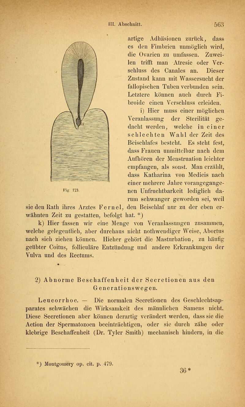 artige Adhäsionen zurück, class es den Fimbrien unmöglich wird, die Ovarien zu umfassen. Zuwei- len trifft man Atresie oder Ver- schluss des Canales an. Dieser Zustand kann mit Wassersucht der fallopischen Tuben verbunden sein. Letztere können auch durch Fi- broide einen Verschluss erleiden. i) Hier muss einer möglichen Veranlassung der Sterilität ge- dacht werden, welche in einer schlechten Wahl der Zeit des Beischlafes besteht. Es steht fest, dass Frauen unmittelbar nach dem Aufhören der Menstruation leichter empfangen, als sonst. Man erzählt, dass Katharina von Medicis nach einer mehrere Jahre vorangegange- nen Unfruchtbarkeit lediglich da- rum schwanger geworden sei, weil sie den Rath ihres Arztes Fernel, den Beischlaf nur zu der eben er- wähnten Zeit zu gestatten, befolgt hat. *) k) Hier fassen wir eine Menge von Veranlassungen zusammen, welche gelegentlich, aber durchaus nicht notwendiger Weise, Abortus nach sich ziehen können. Hieher gehört die Masturbation, zu häufig geübter Coitus, folliculäre Entzündung und andere Erkrankungen der Vulva und des Rectums. Fig. 123. 2) Abnorme Beschaffenheit der Secretionen aus den Generationswegen. Leucorrhoe. — Die normalen Secretionen des Geschlechtsap- parates schwächen die Wirksamkeit des männlichen Samens nicht. Diese Secretionen aber können derartig verändert werden, dass sie die Action der Spermatozoon beeinträchtigen, oder sie durch zähe oder klebrige Beschaffenheit (Dr. Tyler Smith) mechanisch hindern, in die *) Montgomery op. cit. p. 479. 36