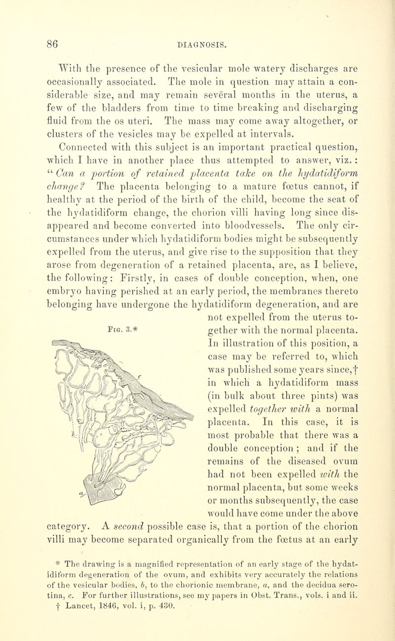 With the presence of the vesicular mole watery discharges are occasionally associated. The mole in question may attain a con- siderable size, and may remain several months in the uterus, a few of the bladders from time to time breaking and discharging fluid from the os uteri. The mass may come away altogether, or clusters of the vesicles may be expelled at intervals. Connected with this subject is an important practical question, which I have in another place thus attempted to answer, viz. :  Can a portion of retained jy^cf'Centa take on the hydatidiform cliange'? The placenta belonging to a mature foetus cannot, if healthy at the period of the birth of the child, become the seat of the hydatidiform change, the chorion villi having long since dis- appeared and become converted into bloodvessels. The only cir- cumstances under which hydatidiform bodies might be subsequently expelled from the uterus, and give rise to the supposition that they arose from degeneration of a retained placenta, are, as I believe, the following: Firstly, in cases of double conception, when, one embryo having perished at an early period, the membranes thereto belonging have undergone the hydatidiform degeneration, and are not expelled from the uterus to- FiG- 3.* gether with the normal placenta. In illustration of this position, a case may be referred to, which was published some years since,f in which a hydatidiform mass (in bulk about three pints) was expelled together with a normal placenta. In this case, it is most probable that there was a double conception ; and if the remains of the diseased ovum had not been expelled with the normal placenta, but some weeks or months subsequently, the case would have come under the above category, A second possible case is, that a portion of the chorion villi may become separated organically from the foetus at an early * The drawing is a magnified representation of an early stage of the hydat- idiform degeneration of the ovum, and exhibits very accurately the relations of the vesicular bodies, 6, to the chorionic membrane, a, and the decidua sero- tina, c. Por further illustrations, see my papers in Obst. Trans., vols, i and ii. t Lancet, 1846, vol. i, p. 430.