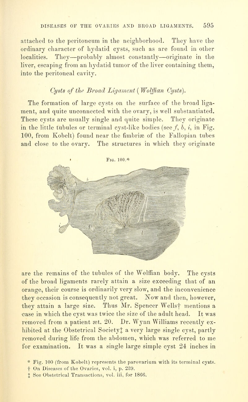 attached to the peritoneum in the neighborhood. They have the ordinary character of hydatid cysts, such as are found in other localities. They—probably almost constantly—originate in the liver, escaping from an hydatid tumor of the liver containing them, into the peritoneal cavity. Cysts of tlip Broad Ligament [Wolffian Cysts). The formation of large cysts on the surface of the broad liga- ment, and quite unconnected with the ovary, is well substantiated. These cysts are usually single and quite simple. They originate in the little tubules or terminal cyst-like bodies (see/, 5, ^, in Fig. 100, from Kobelt) found near the fimbriae of the Fallopian tubes and close to the ovary. The structures in which they originate • Fig, 100.^ t ' are the remains ©f the tubules of the Wolffian body. The cysts of the broad ligaments rarely attain a size exceeding that of an orange, their course is ordinarily very slow, and the inconvenience they occasion is consequeBtly not great. JSTow and then, however, they attain a large size. Thus Mr. Spencer Wellsf mentions a case in which the cyst was twice the size of the adult head. It was removed from a patient set. 20. Dr. Wynn Williams recently ex- hibited at the Obstetrical Societyj a very large single cyst, partly removed during life from the abdomen, which was referred to me for examination. It was a single large simple cyst 24 inches in * Fig. 100 (from Kobelt) represents the parovarium with its terminal cysts. f On Diseases of the Ovaries, vol. i, p. 239. X See Obstetrical Transactions, vol. iii, for 1866.