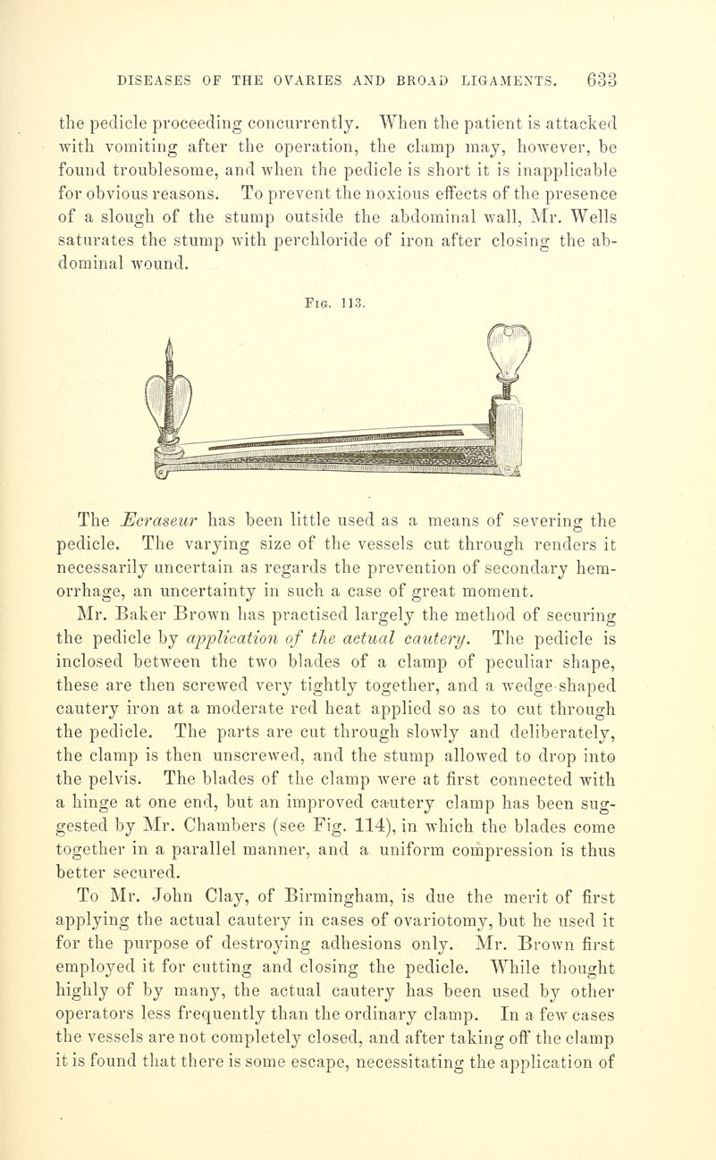 the pedicle proceeding concurrently. When the patient is attacked with vomiting after the operation, the clamp may, however, be found troublesome, and when the pedicle is short it is inapplicable for obvious reasons. To prevent the noxious effects of the presence of a slough of the stump outside the abdominal wall, Mr. Wells saturates the stump with perchloride of iron after closing the ab- dominal wound. Fig. 113. The Ecraseur has been little used as a means of severing the pedicle. The varying size of the vessels cut through renders it necessarily uncertain as regards the prevention of secondary hem- orrhage, an uncertainty in such a case of great moment. Mr. Baker Brown has practised largely the method of securing the pedicle by application of the actual cautery. The pedicle is inclosed between the two blades of a clamp of peculiar shape, these are then screwed very tightly together, and a wedge-shaped cautery iron at a moderate red heat applied so as to cut through the pedicle. The parts are cut through slowly and deliberately, the clamp is then unscrewed, and the stump allowed to drop into the pelvis. The blades of the clamp Avere at first connected with a hinge at one end, but an improved ca-utery clamp has been sug- gested by Mr. Chambers (see Fig. 114), in which the blades come together in a parallel manner, and a uniform compression is thus better secured. To Mr. John Clay, of Birmingham, is due the merit of first applying the actual cautery in cases of ovariotomy, but he used it for the purpose of destrojang adhesions only. Mr. Brown first employed it for cutting and closing the pedicle. While thought highly of by many, the actual cautery has been used by other operators less frequently than the ordinary clamp. In a few cases the vessels are not completely closed, and after taking off the clamp it is found that there is some escape, necessitating the application of
