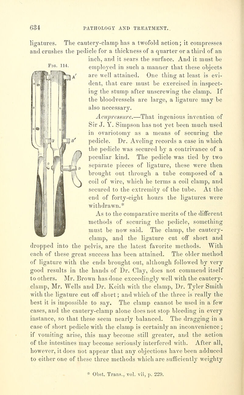 Fig. 114. ligatures. The cautery-clamp has a twofold action; it compresses and crushes the pedicle for a thickness of a quarter or a third of an inch, and it sears the surface. And it must be employed in such a manner that these objects are well attained. One thing at least is evi- dent, that care must be exercised in inspect- ing the stump after unscrewing the clamp. If the bloodvessels are large, a ligature may be also necessary. Acupressure.—That ingenious invention of Sir J. Y. Simpson has not yet been much used in ovariotomy as a means of securing the pedicle. Dr. Aveling records a case in which the pedicle was secured by a contrivance of a peculiar kind. The pedicle was tied by two separate pieces of ligature, these were then brought out through a tube composed of a coil of Avire, which he terms a coil clamp, and secured to the extremity of the tube. At the end of forty-eight hours the ligatures Avere withdrawn.* As to the comparative merits of the different methods of securing the pedicle, something must be now said. The clamp, the cautery- clamp, and the ligature cut off short and dropped into the pelvis, are the latest favorite methods. With each of these great success has been attained. The older method of ligature with the ends brought out, although followed by very good results in the hands of Dr. Clay, does not commend itself to others. Mr. Brown has done exceedingly well with the cautery- clamp, Mr. Wells and Dr. Keith with the clamp. Dr. Tyler Smith with the ligature cut off short; and which of the three is really the best it is impossible to say. The clamp cannot be used in a few cases, and the cautery-clamp alone does not stop bleeding in every instance, so that these seem nearly balanced. The dragging in a case of short pedicle with the clamp is certainly an inconvenience ; if vomiting arise, this may become still greater, and the action of the intestines may become seriously interfered with. After all, however, it does not appear that any objections have been adduced to either one of these three methods which are sufficiently weighty Obst. Trans., vol. vii, p. 229.