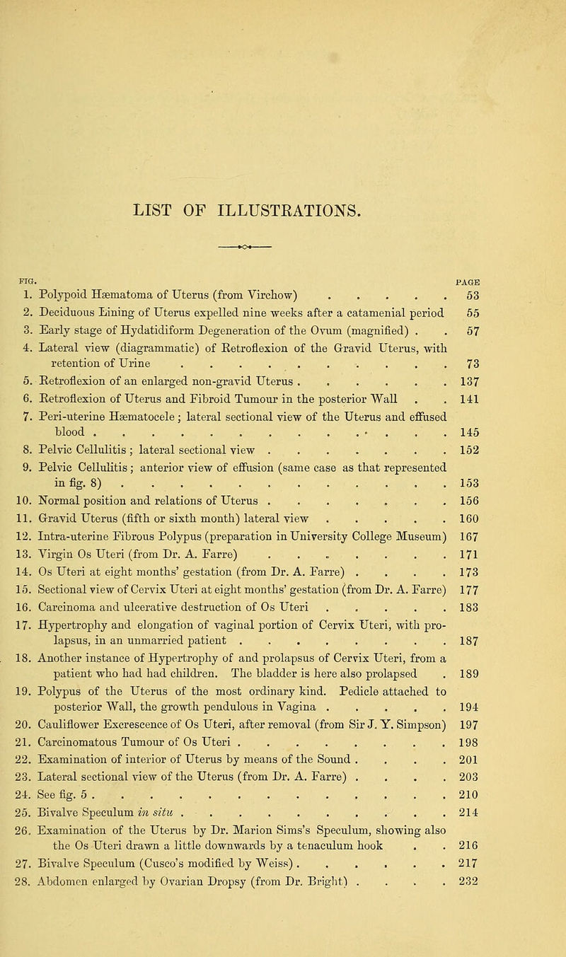 LIST OF ILLUSTRATIONS. PIG. PAGE 1. Polypoid Hsematonia of Uterus (from Virchow) 53 2. Deciduous Lining of Uterus expelled nine weeks after a catamenial period 55 3. Early stage of Hydatidiform Degeneration of the Ovum (magnified) . . 57 4. Lateral view (diagrammatic) of Eetroflexion of the Gravid Uterus, with retention of Urine 73 5. Eetroflexion of an enlarged non-gravid Uterus . . . . . .137 6. Eetroflexion of Uterus and Fibroid Tumour in the posterior Wall . .141 7. Peri-uterine Hsematocele ; lateral sectional view of the Uterus and effused blood 145 8. Pelvic Cellulitis ; lateral sectional view 152 9. Pelvic Cellulitis; anterior view of effusion (same case as that represented in fig. 8) 153 10. Normal position and relations of Uterus . . . . . . .156 11. Gravid Uterus (fifth or sixth month) lateral view . . . . .160 12. Intra-uterine Pibrous Polypus (preparation in University College Museum) 167 13. Virgin Os Uteri (from Dr. A. Farre) . . „ . . . .171 14. Os Uteri at eight months' gestation (from Dr. A. Farre) . . . .173 15. Sectional view of Cervix Uteri at eight months' gestation (from Dr. A. Farre) 177 16. Carcinoma and ulcerative destruction of Os Uteri ..... 183 17. Hypertrophy and elongation of vaginal portion of Cervix Uteri, with pro- lapsus, in an unmarried patient . . . . . . . .187 18. Another instance of Hypertrophy of and prolapsus of Cervix Uteri, from a patient who had had children. The bladder is here also prolapsed . 189 19. Polypus of the Uterus of the most ordinary kind. Pedicle attached to posterior Wall, the growth pendulous in Vagina . . . . .194 20. Cauliflower Excrescence of Os Uteri, after removal (from Sir J. Y. Simpson) 197 21. Carcinomatous Tumour of Os Uteri .198 22. Examination of interior of Uterus by means of the Sound .... 201 23. Lateral sectional view of the Uterus (from Dr. A. Farre) .... 203 24. See fig. 5 210 25. Bivalve Speculum in situ . . . . . . . . .214 26. Examination of the Uterus by Dr. Marion Sims's Speculum, showing also the Os Uteri drawn a little downwards by a tenaculum hook . .216 27. Bivalve Speculum (disco's modified by Weiss) 217 28. Abdomen enlarged by Ovarian Dropsy (from Dr. Bright) .... 232