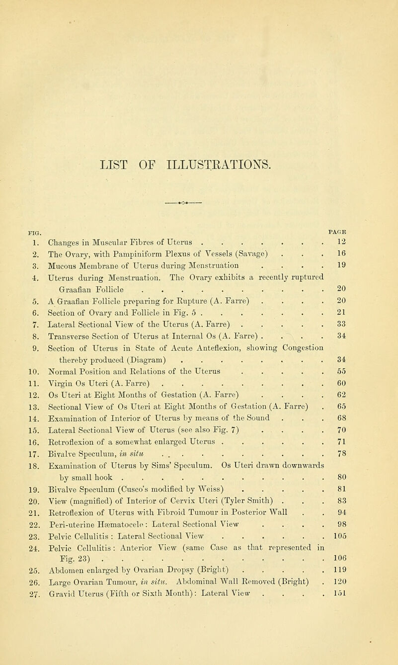 LIST OF ILLUSTBATIONS. FIG. PAGE 1. Changes in Muscular Fibres of Uterus 12 2. The Ovary, with Pampiniform Plexus of Vessels (Savage) . . .16 3. Mucous Membrane of Uterus during Menstruation .... 19 4. Uterus during Menstruation. The Ovary exhibits a recently ruptured Graafian Follicle 20 5. A Graafian Follicle preparing for Eupture (A. Farre) .... 20 6. Section of Ovary and Follicle in Fig. 5 21 7. Lateral Sectional View of the Uterus (A. Farre) 33 8. Transverse Section of Uterus at Internal Os (A. Farre) . • ~\ ■ • ^4 9. Section of Uterus in State of Acute Anteflexion, showing Congestion thereby produced (Diagram) ........ 34 10. Normal Position and Relations of the Uterus ..... 55 11. Virgin Os Uteri (A. Farre) 60 12. Os Uteri at Eight Months of Gestation (A. Farre) . . . .62 13. Sectional View of Os Uteri at Eight Months of Gestation (A. Farre) . 65 14. Examination of Interior of Uterus by means of the Sound ... 68 15. Lateral Sectional View of Uterus (see also Fig. 7) .... 70 16. Retroflexion of a somewhat enlarged Uterus 71 17. Bivalve Speculum, in situ, . 78 18. Examination of Uterus by Sims' Speculum. Os Uteri drawn downwards by small hook ........... 80 19. Bivalve Speculum (disco's modified by Weiss) 81 20. View (magnified) of Interior of Cervix Uteri (Tyler Smith) . . .83 21. Retroflexion of Uterus with Fibroid Tumour in Posterior Wall . . 94 22. Peri-uterine Hsematoeele: Lateral Sectional View . . . .98 23. Pelvic Cellulitis : Lateral Sectional View 105 24. Pelvic Cellulitis: Anterior View (same Case as that represented in Fig. 23) 106 25. Abdomen enlarged by Ovarian Dropsy (Bright) 119 26. Large Ovarian Tumour, in situ. Abdominal Wall Removed (Bright) . 120 27. Gravid Uterus (Fifth or Sixth Month): Lateral View . . . .151