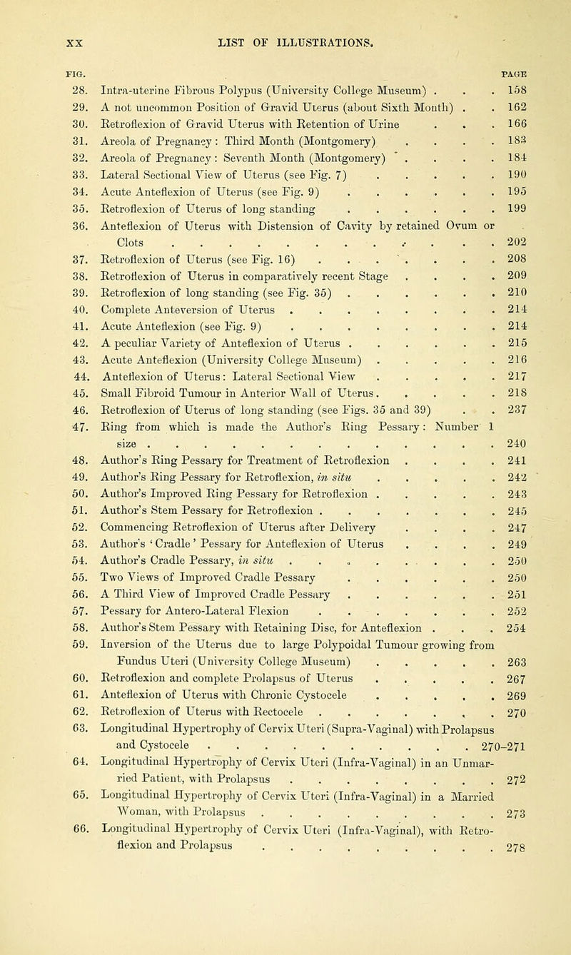 FIG. 28. Intra-uterine Fibrous Polypus (University College Museum) . 29. A not uncommon Position of Gravid Uterus (about Sixth Mouth) 30. Eetroflexion of Gravid Uterus with Retention of Urine 31. Areola of Pregnancy : Third Month (Montgomery) 32. Areola of Pregnancy : Seventh Month (Montgomery)  . 33. Lateral Sectional View of Uterus (see Fig. 7) 34. Acute Anteflexion of Uterus (see Fig. 9) 35. Eetroflexion of Uterus of long standing .... 36. Anteflexion of Uterus with Distension of Cavity by retained Ovum or Clots 37. Eetroflexion of Uterus (see Fig. 16) . . . 38. Eetroflexion of Uterus in comparatively recent Stage 39. Eetroflexion of long standing (see Fig. 35) 40. Complete Anteversion of Uterus 41. Acute Anteflexion (see Fig. 9) 42. A peculiar Variety of Anteflexion of Uterus . 43. Acute Anteflexion (University College Museum) 44. Anteflexion of Uterus: Lateral Sectional View 45. Small Fibroid Tumour in Anterior Wall of Uterus 46. Eetroflexion of Uterus of long standing (see Figs. 35 and 39) 47. Eing from which is made the Author's Eing Pessary: Number 48. Author's Eing Pessary for Treatment of Eetroflexion 49. Author's Eing Pessary for Eetroflexion, in situ .... 50. Author's Improved Eing Pessary for Eetroflexion .... 51. Author's Stem Pessary for Eetroflexion ...... 52. Commencing Eetroflexion of Uterus after Delivery 53. Author's ' Cradle ' Pessary for Anteflexion of Uterus 54. Author's Cradle Pessary, in situ . . „ . ... 55. Two Views of Improved Cradle Pessary ..... 56. A Third View of Improved Cradle Pessary ..... 57- Pessary for Antero-Lateral Flexion ...... 58. Author's Stem Pessary with Eetaining Disc, for Anteflexion . 59. Inversion of the Uterus due to large Polypoidal Tumour growing from Fundus Uteri (University College Museum) .... 60. Eetroflexion and complete Prolapsus of Uterus .... 61. Anteflexion of Uterus with Chronic Cystocele .... 62. Eetroflexion of Uterus with Eectocele ...... 63. Longitudinal Hypertrophy of Cervix Uteri (Supra-Vaginal) with Prolapsus and Cystocele 270-271 64. Longitudinal Hypertrophy of Cervix Uteri (Infra-Vaginal) in an Unmar- ried Patient, with Prolapsus 272 65. Longitudinal Hypertrophy of Cervix Uteri (Infra-Vaginal) in a Married Woman, with Prolapsus ......... 273 66. Longitudinal Hypertrophy of Cervix Uteri (Infra-Vaginal), with Eetro- flexion and Prolapsus ......... 278