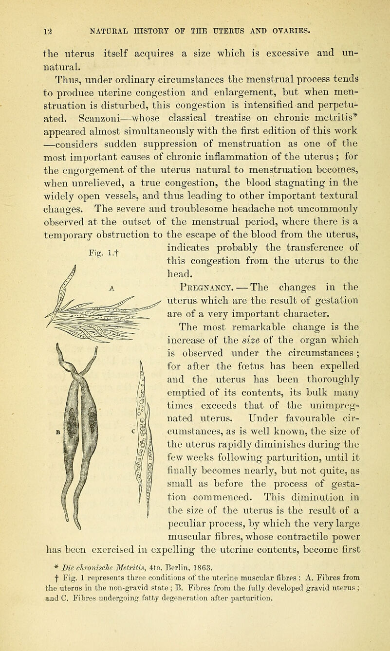 Fig. l.f the uterus itself acquires a size which is excessive and un- natural. Thus, under ordinary circumstances the menstrual process tends to produce uterine congestion and enlargement, but when men- struation is disturbed, this congestion is intensified and perpetu- ated. Scanzoni—whose classical treatise on chronic metritis* appeared almost simultaneously with the first edition of this work —considers sudden suppression of menstruation as one of the most important causes of chronic inflammation of the uterus ; for the engorgement of the uterus natural to menstruation becomes, when unrelieved, a true congestion, the blood stagnating in the widely open vessels, and thus leading to other important textural changes. The severe and troublesome headache not uncommonly observed at the outset of the menstrual period, where there is a temporary obstruction to the escape of the blood from the uterus, indicates probably the transference of this congestion from the uterus to the head. Pregnancy. — The changes in the uterus which are the result of gestation are of a very important character. The most remarkable change is the increase of the size of the organ which is observed under the circumstances; for after the foetus has been expelled and the uterus has been thoroughly emptied of its contents, its bulk many times exceeds that of the unimpreg- nated uterus. Under favourable cir- cumstances, as is well known, the size of the uterus rapidly diminishes during the few weeks following parturition, until it finally becomes nearly, but not quite, as small as before the process of gesta- tion commenced. This diminution in the size of the uterus is the result of a peculiar process, by which the very large muscular fibres, whose contractile power has been exercised in expelling the uterine contents, become first * Die chronische Metritis, 4to. Berlin, 1863. f Fig. 1 represents three conditions of the uterine muscular fibres : A. Fibres from the uterus in the non-gravid state; B. Fibres from the fully developed gravid uterus ; and C. Fibres undergoing fatty degeneration after parturition.