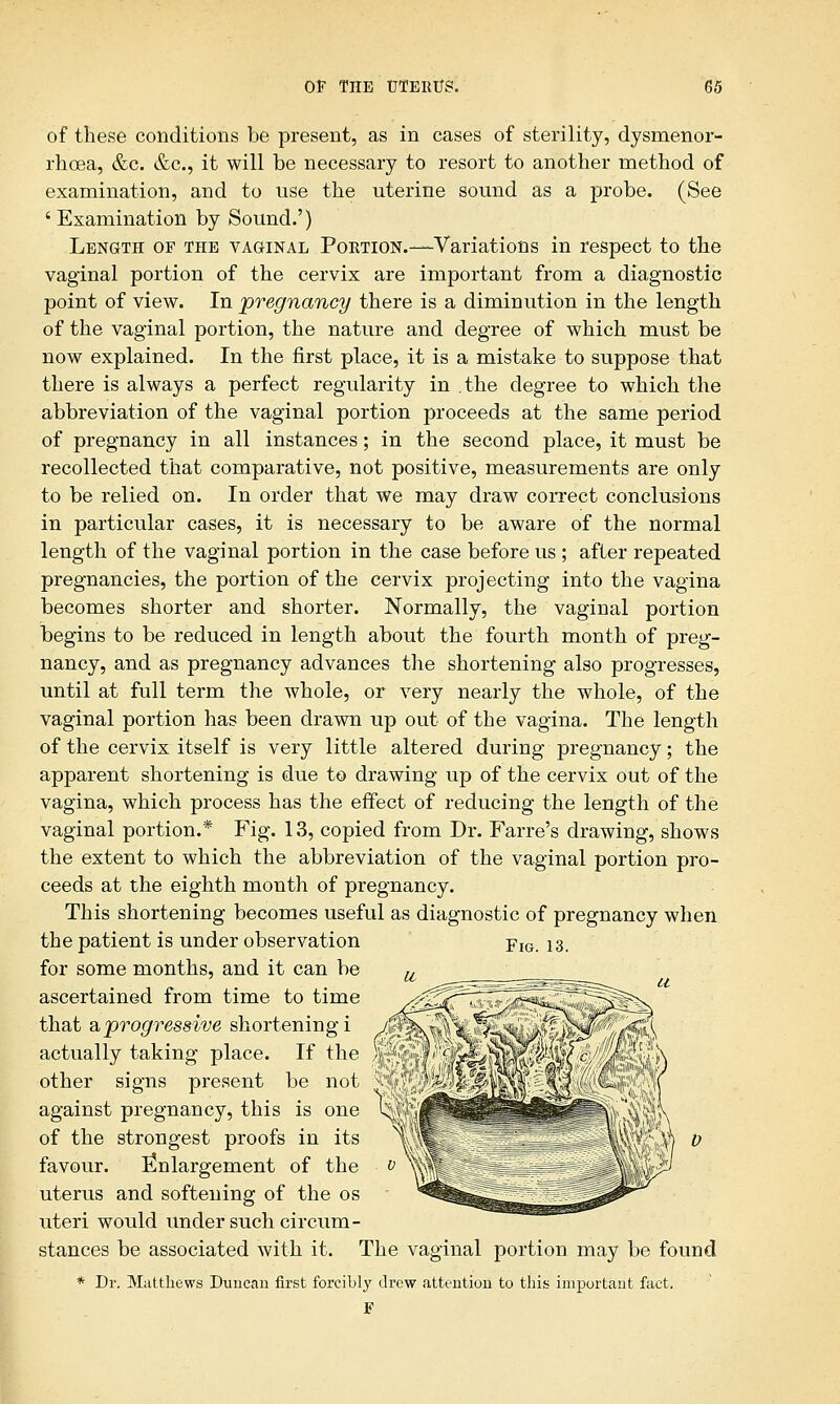 of these conditions be present, as in cases of sterility, dysmenor- rhcea, &c. &c, it will be necessary to resort to another method of examination, and to use the uterine sound as a probe. (See ' Examination by Sound.') Length of the vaginal Portion.— Variations in respect to the vaginal portion of the cervix are important from a diagnostic point of view. In 'pregnancy there is a diminution in the length of the vaginal portion, the nature and degree of which must be now explained. In the first place, it is a mistake to suppose that there is always a perfect regularity in .the degree to which the abbreviation of the vaginal portion proceeds at the same period of pregnancy in all instances; in the second place, it must be recollected that comparative, not positive, measurements are only to be relied on. In order that we may draw correct conclusions in particular cases, it is necessary to be aware of the normal length of the vaginal portion in the case before us ; after repeated pregnancies, the portion of the cervix projecting into the vagina becomes shorter and shorter. Normally, the vaginal portion begins to be reduced in length about the fourth month of preg- nancy, and as pregnancy advances the shortening also progresses, until at full term the whole, or very nearly the whole, of the vaginal portion has been drawn up out of the vagina. The length of the cervix itself is very little altered during pregnancy; the apparent shortening is due to drawing up of the cervix out of the vagina, which process has the effect of reducing the length of the vaginal portion.* Fig. 13, copied from Dr. Farre's drawing, shows the extent to which the abbreviation of the vaginal portion pro- ceeds at the eighth month of pregnancy. This shortening becomes useful as diagnostic of pregnancy when the patient is under observation FIG ^ for some months, and it can be ascertained from time to time that a.progressive shortening i actually taking place. If the other signs present be not against pregnancy, this is one li^ of the strongest proofs in its favour. Enlargement of the uterus and softening of the os uteri would under such circum- stances be associated with it. The vaginal portion may be found * Dr. Matthews Duncan first forcibly drew attention to this important fact. F