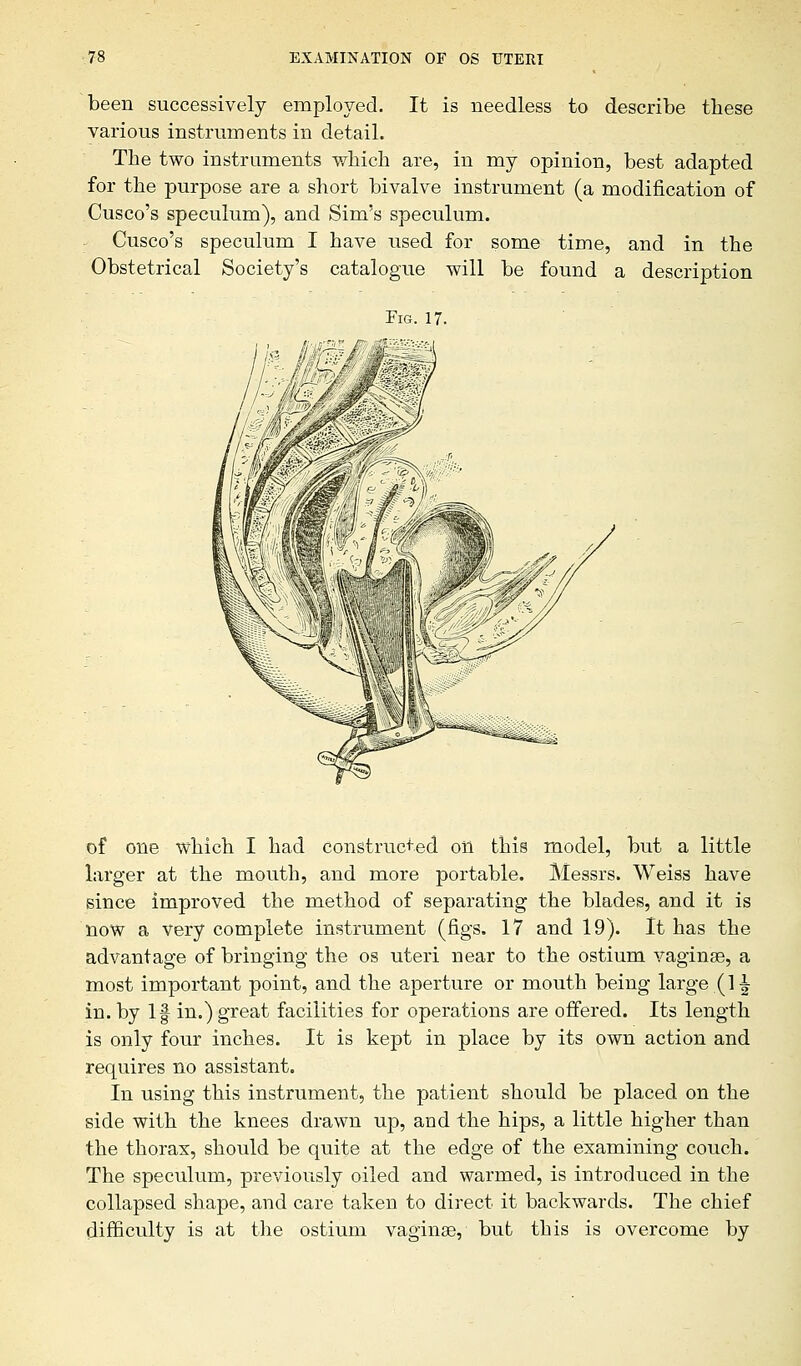 been successively employed. It is needless to describe these various instruments in detail. The two instruments which are, in my opinion, best adapted for the purpose are a short bivalve instrument (a modification of Cusco's speculum), and Sim's speculum. Cusco's speculum I have used for some time, and in the Obstetrical Society's catalogue will be found a description Fig. 17. of one which I had constructed on this model, but a little larger at the mouth, and more portable. Messrs. Weiss have since improved the method of separating the blades, and it is now a very complete instrument (figs. 17 and 19). It has the advantage of bringing the os uteri near to the ostium vagina?, a most important point, and the aperture or mouth being large (1^ in. by If in.) great facilities for operations are offered. Its length is only four inches. It is kept in place by its own action and requires no assistant. In using this instrument, the patient should be placed on the side with the knees drawn up, and the hips, a little higher than the thorax, should be quite at the edge of the examining couch. The speculum, previously oiled and warmed, is introduced in the collapsed shape, and care taken to direct it backwards. The chief difficulty is at the ostium vagina?, but this is overcome by