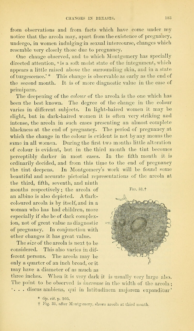 from observations and from facts which have come under my notice that the areola may, apart from the existence of pregnancy, undergo, in women indulging in sexual intercourse, changes which resemble very closely those due to pregnancy. One change observed, and to which Montgomery has specially directed attention, 'is a soft moist state of the integument, which appears a little raised above the surrounding skin, and in a state of turgescence.' * This change is observable as early as the end of the second month. It is of more diagnostic value in the case of primiparse. The deepening of the colour of the areola is the one which has been the best known. The degree of the change in the colour varies in different subjects. In light-haired women it may be slight, but in dark-haired women it is often very striking and intense, the areola in such cases presenting an almost complete blackness at the end of pregnancy. The period of pregnancy at which the change in the colour is evident is not by any means the same in all women. Daring the first two months little alteration of colour is evident, but in the third month the tint becomes perceptibly darker in most cases. In the fifth month it is ordinarily decided, and from this time to the end of pregnancy the tint deepens. In Montgomery's work will be found some beautiful and accurate pictorial representations of the areola at the third, fifth, seventh, and ninth months respectively; the areola of Fig. 31.f an albino is also depicted. Atlark- ___Js\ coloured areola is by itself, and in a woman who has had children, more j| especially if she be of dark complex- ,;-jf ^ijl of pregnancy. In conjunction with other changes it has great value. ,f; ■ '',';.. .if' i ■)■• ; rcul:1 .' ,^--. \ {:■, \ ,■■ ': ..- considered. This also varies in dif- *-*- jfif^ ferent persons. The areola may be * •#05-31 only a quarter of an inch broad, or it )■ may have a diameter of as much as three inches. When it is very dark it is usually very large also. The point to be observed is increase in the width of the areola; *. . . discus ambiens, qui in latitudinem majorem expanditur' * Op. cit. p. 105. t Fig- 31, after Montgomery, shows areola at third month.