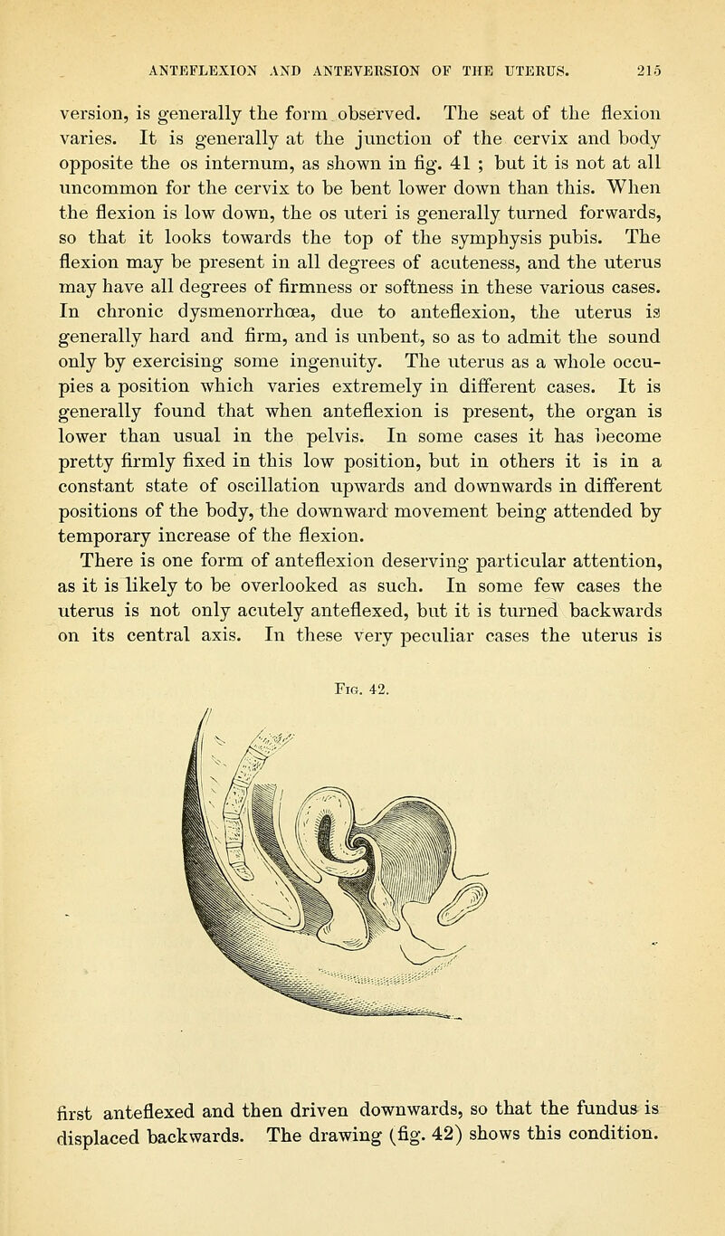 version, is generally the form observed. The seat of the flexion varies. It is generally at the junction of the cervix and body opposite the os internum, as shown in fig. 41 ; but it is not at all uncommon for the cervix to be bent lower down than this. When the flexion is low down, the os uteri is generally turned forwards, so that it looks towards the top of the symphysis pubis. The flexion may be present in all degrees of acuteness, and the uterus may have all degrees of firmness or softness in these various cases. In chronic dysmenorrhoea, due to anteflexion, the uterus is generally hard and firm, and is unbent, so as to admit the sound only by exercising some ingenuity. The uterus as a whole occu- pies a position which varies extremely in different cases. It is generally found that when anteflexion is present, the organ is lower than usual in the pelvis. In some cases it has become pretty firmly fixed in this low position, but in others it is in a constant state of oscillation upwards and downwards in different positions of the body, the downward movement being attended by temporary increase of the flexion. There is one form of anteflexion deserving particular attention, as it is likely to be overlooked as such. In some few cases the uterus is not only acutely anteflexed, but it is turned backwards on its central axis. In these very peculiar cases the uterus is Fig. 42. first anteflexed and then driven downwards, so that the fundus is displaced backwards. The drawing (fig. 42) shows this condition.