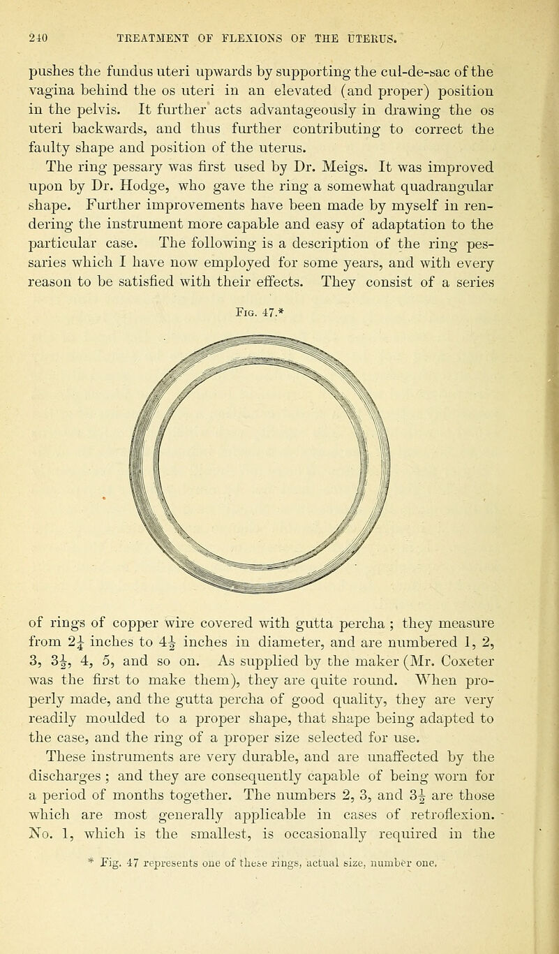 pushes the fundus uteri upwards by supporting the cul-de-sac of the vagina behind the os uteri in an elevated (and proper) position in the pelvis. It further acts advantageously in drawing the os uteri backwards, and thus further contributing to correct the faulty shape and position of the uterus. The ring pessary was first used by Dr. Meigs. It was improved upon by Dr. Hodge, who gave the ring a somewhat quadrangular shape. Further improvements have been made by myself in ren- dering the instrument more capable and easy of adaptation to the particular case. The following is a description of the ring pes- saries which I have now employed for some years, and with every reason to be satisfied with their effects. They consist of a series Fig. 47.* of rings of copper wire covered with gutta percha ; they measure from 2£ inches to A.\ inches in diameter, and are numbered 1, 2, 3, 3^, 4, 5, and so on. As supplied by the maker (Mr. Coxeter was the first to make them), they are quite round. When pro- perly made, and the gutta percha of good quality, they are very readily moulded to a proper shape, that shape being adapted to the case, and the ring of a proper size selected for use. These instruments are very durable, and are unaffected by the discharges ; and they are consequently capable of being worn for a period of months together. The numbers 2, 3, and 3^ are those which are most generally applicable in cases of retroflexion. No. 1, which is the smallest, is occasionally required in the * Fig. 47 represents one of these rings, actual size, number one.