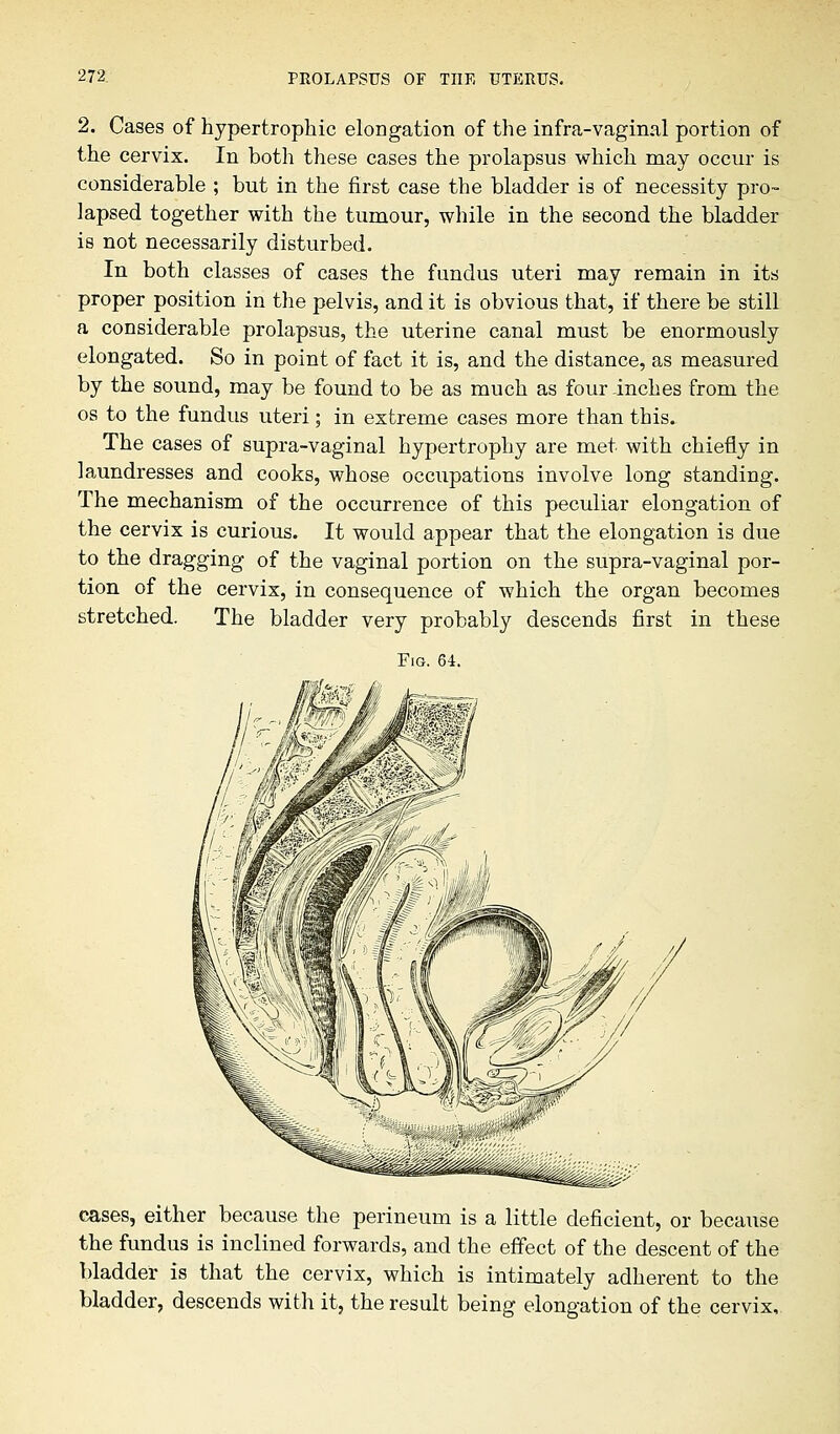 2. Cases of hypertrophic elongation of the infra-vaginal portion of the cervix. In both these cases the prolapsus which may occur is considerable ; but in the first case the bladder is of necessity pro- lapsed together with the tumour, while in the second the bladder is not necessarily disturbed. In both classes of cases the fundus uteri may remain in its proper position in the pelvis, and it is obvious that, if there be still a considerable prolapsus, the uterine canal must be enormously elongated. So in point of fact it is, and the distance, as measured by the sound, may be found to be as much as four inches from the os to the fundus uteri; in extreme cases more than this. The cases of supra-vaginal hypertrophy are met with chiefly in laundresses and cooks, whose occupations involve long standing. The mechanism of the occurrence of this peculiar elongation of the cervix is curious. It would appear that the elongation is due to the dragging of the vaginal portion on the supra-vaginal por- tion of the cervix, in consequence of which the organ becomes stretched. The bladder very probably descends first in these Fig. 64. cases, either because the perineum is a little deficient, or because the fundus is inclined forwards, and the effect of the descent of the bladder is that the cervix, which is intimately adherent to the bladder, descends with it, the result being elongation of the cervix,