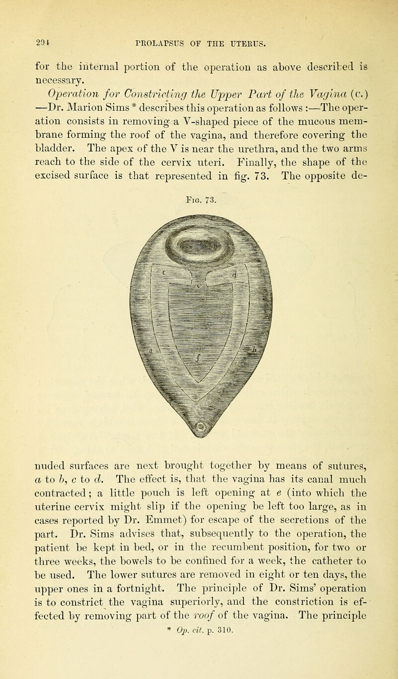 for the internal portion of the operation as above described is necessary. Operation for Constricting the Upper Part of the Vagina (c.) —Dr. Marion Sims * describes this operation as follows :—The oper- ation consists in removing a V-shaped piece of the mucous mem- brane forming the roof of the vagina, and therefore covering the bladder. The apex of the V is near the urethra, and the two arms reach to the side of the cervix uteri. Finally, the shape of the excised surface is that represented in fig. 73. The opposite de- Fm. 73. nuded surfaces are next brought together by means of sutures, a to h, c to d. The effect is, that the vagina has its canal much contracted; a little pouch is left opening at e (into which .the uterine cervix might slip if the opening be left too large, as in cases reported by Dr. Emmet) for escape of the secretions of the part. Dr. Sims advises that, subsequently to the operation, the patient be kept in bed, or in the recumbent position, for two or three weeks, the bowels to be confined for a week, the catheter to be used. The lower sutures are removed in eight or ten days, the upper ones in a fortnight. The principle of Dr. Sims' operation is to constrict the vagina superiorly, and the constriction is ef- fected by removing part of the roof of the vagina. The principle * Op. tit. p. 310.