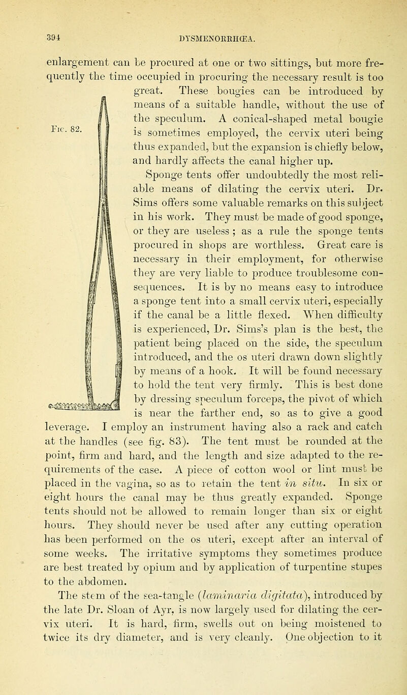 Fig. 82. enlargement can be procured at one or two sittings, but more fre- quently the time occupied in procuring the necessary result is too great. These bougies can be introduced by means of a suitable handle, without the use of the speculum. A conical-shaped metal bougie is sometimes employed, the cervix uteri being thus expanded, but the expansion is chiefly below, and hardly affects the canal higher up. Sponge tents offer undoubtedly the most reli- able means of dilating the cervix uteri. Dr. Sims offers some valuable remarks on this subject in his work. They must be made of good sponge, or they are useless ; as a rule the sponge tents procured in shops are worthless. Great care is necessary in their employment, for otherwise they are very liable to produce troublesome con- sequences. It is by no means easy to introduce a sponge tent into a small cervix uteri, especially if the canal be a little flexed. When difficulty is experienced, Dr. Sims's plan is the best, the patient being placed on the side, the speculum introduced, and the os uteri drawn down slightly by means of a hook. It will be found necessary to hold the tent very firmly. This is best done by dressing speculum forceps, the pivot of which is near the farther end, so as to give a good leverage. I employ an instrument having also a rack and catch at the handles (see fig. S3). The tent must be rounded at the point, firm and hard, and the length and size adapted to the re- quirements of the case. A piece of cotton wool or lint must be placed in the vagina, so as to retain the tent in situ. In six or eight hours the canal may be thus greatly expanded. Sponge tents should not be allowed to remain longer than six or eight hours. They should never be used after any cutting operation has been performed on the os uteri, except after an interval of some weeks. The irritative symptoms they sometimes produce are best treated by opium and by application of turpentine stupes to the abdomen. The stem of the sea-tangle (laminaria digitata), introduced by the late Dr. Sloan of Ayr, is now largely, used for dilating the cer- vix uteri. It is hard, firm, swells out on being moistened to twice its dry diameter, and is very cleanly. One objection to it