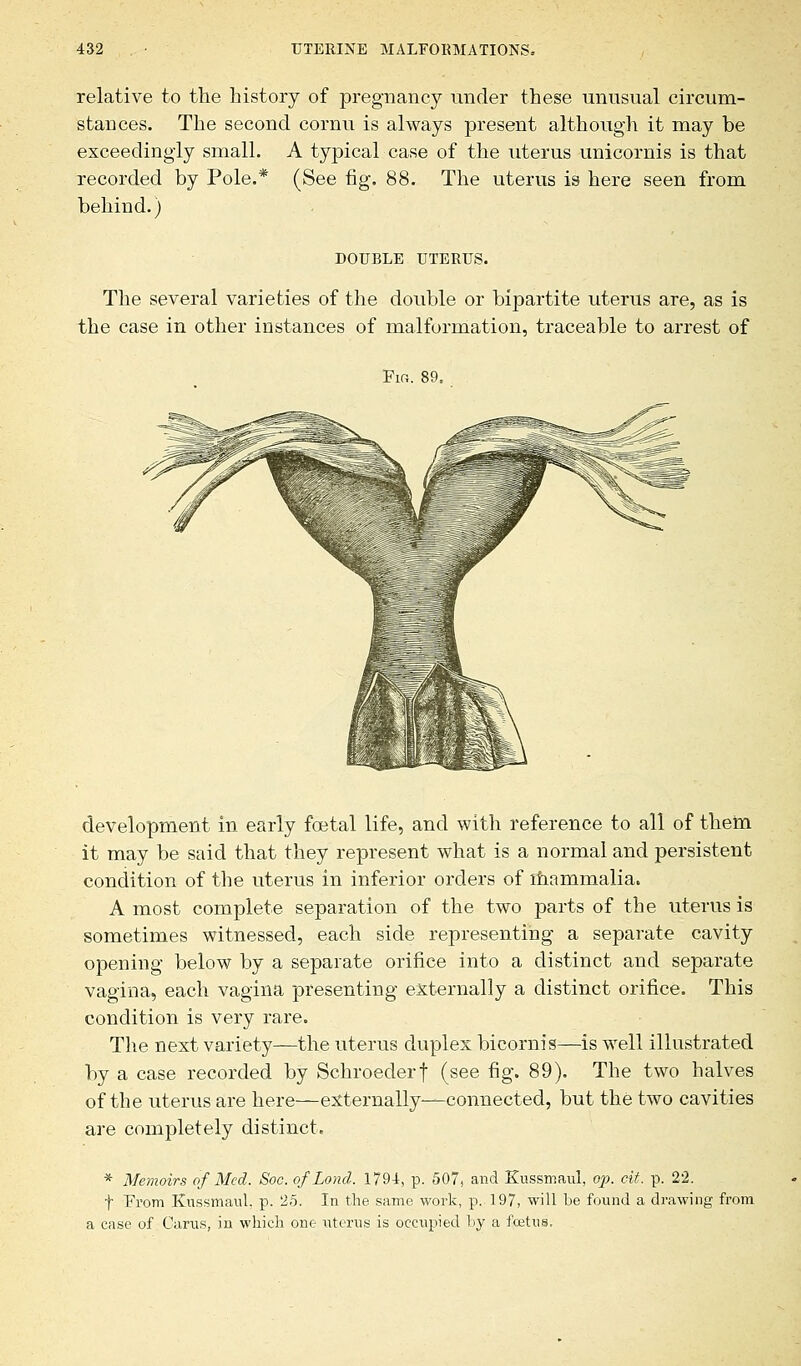 relative to the history of pregnancy under these unusual circum- stances. The second cornu is always present although it may be exceedingly small. A typical case of the uterus unicornis is that recorded by Pole.* (See fig. 88. The uterus is here seen from behind.) DOUBLE UTERUS. The several varieties of the double or bipartite uterus are, as is the case in other instances of malformation, traceable to arrest of Fi«. 89. development in early foetal life, and with reference to all of them it may be said that they represent what is a normal and persistent condition of the uterus in inferior orders of mammalia. A most complete separation of the two parts of the uterus is sometimes witnessed, each side representing a separate cavity opening below by a separate orifice into a distinct and separate vagina, each vagina presenting externally a distinct orifice. This condition is very rare. The next variety—the uterus duplex bicornis—is well illustrated by a case recorded by Schroederf (see fig. 89). The two halves of the uterus are here—externally—connected, but the two cavities are completely distinct. * Memoirs of Med. Soc. o/Loncl. 1794, p. 507, and Kussmaul, op. cit. p. 22. f Prom Kussmaul. p. 25. In the same work, p. 197, will be found a drawing from a case of Cams, in which one uterus is occupied by a fcetus.