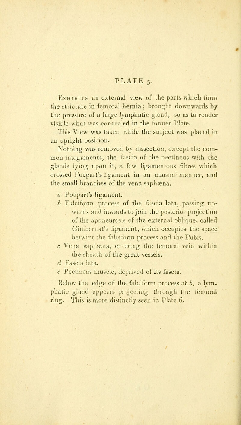Exhibits an external view of the parts which form the stricture in femoral hernia; brought downwards by the pressure of a large lymphatic gland^ so as to render visible what was concealed in the ibrmer Plate. This View was taken while the subject was placed in an upright position. Nothing was removed by dissection^ except the com- mon integuments, the i^seia of the pectineus with the glands iving upon it, a few ligamentous fibres which crossed Poupart's ligament in an unusual manner, and the small branches of the vena saphsena. a Poupart's ligament. b Falciform process of the fascia lata, passing up- wards and inwards to join the posterior projection of the aponeurosis of the external oblique, called Gimbernat's ligament, which occupies the space betv/ixt the falciform process and the Pubis. c Vena saphaEoa, entering the femoral vein within the sheath of the great vessels. d Fascia lata. e Pectineus muscle, deprived of its fascia. Below the edge of the falciform process at b, a lym- phatic gland appears projecting through the femoral