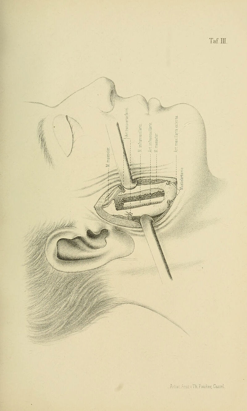 Taf.ffi. 4- m: ' i ' 1 hi'Us:.r'fisi.v.Th.f ischer, Cassel.