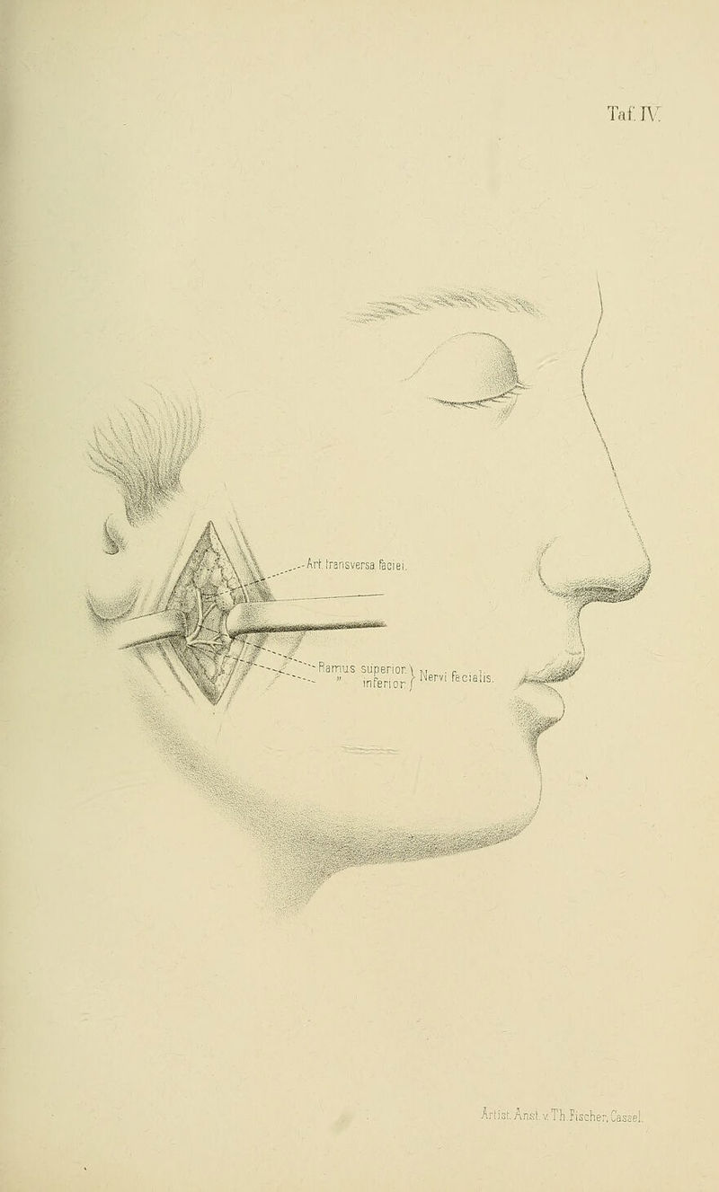 ' '^^ü^:^'::^^' ,.'ArL transversa Tacjei Tai: r\' .. ■-Ramus süperior.\  inferior/ Nervi Facialis. Arlist.Ar!si.v.T}!iischer,Cassel.