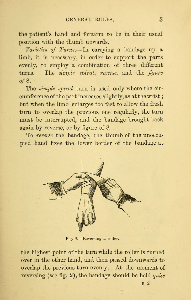 the patient's hand and forearm to be in their usual position with the thumb upwards. Varieties of Turns.—In carrying a bandage up a limb, it is necessary, in order to support the parts evenly, to employ a combination of three different turns. The simple sjnral, reverse, and the figure ofS. The simple spiixd turn is used only where the cir- cumference of the part increases slightly; as at the wrist; but when the limb enlarges too fast to allow the fresh turn to overlap the previous one regularly, the turn must be interrupted, and the bandage brought back again by reverse, or by figure of 8. To reverse the bandage, the thumb of the unoccu- pied hand fixes the lower border of the bandage at Fig. 2.—Keversiug a roller. the highest point of the turn while the roller is turned over in the other hand, and then passed downwards to overlap the previous turn evenly. At the moment of reversing (see fig. 2), the bandage should be held quite B 2