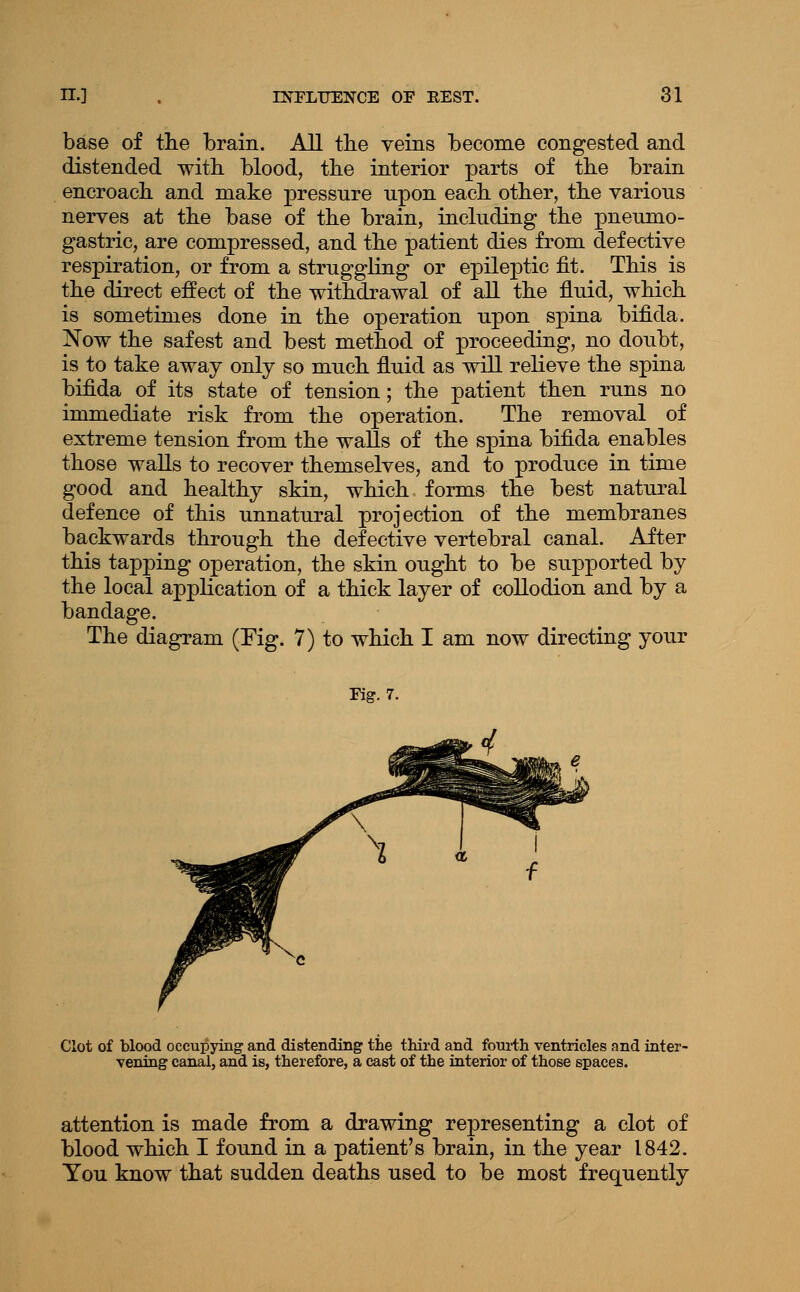 base of tlie brain. All tbe veins become congested and distended with blood, tbe interior parts of the brain encroach and make pressure upon each other, the various nerves at the base of the brain, including the pneumo- gastric, are compressed, and the patient dies from defective respiration, or from a struggling or epileptic fit. This is the direct effect of the withdrawal of all the fluid, which is sometimes done in the operation upon spina bifida. Now the safest and best method of proceeding, no doubt, is to take away only so much fluid as will relieve the spina bifida of its state of tension; the patient then runs no immediate risk from the operation. The removal of extreme tension from the walls of the spina bifida enables those walls to recover themselves, and to produce in time good and healthy skin, which forms the best natural defence of this unnatural projection of the membranes backwards through the defective vertebral canal. After this tapping operation, the skin ought to be supported by the local application of a thick layer of collodion and by a bandage. The diagram (Fig. 7) to which I am now directing your Kg. 7. Clot of blood occupying and distending the third and fourth ventricles and inter- vening canal, and is, therefore, a cast of the interior of those spaces. attention is made from a drawing representing a clot of blood which I found in a patient's brain, in the year 1842. You know that sudden deaths used to be most frequently
