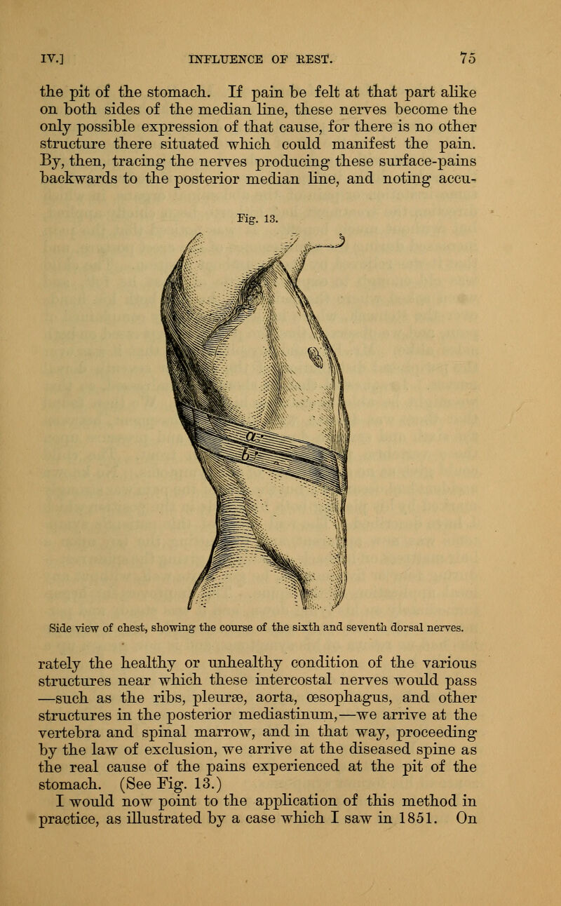 the pit of tlie stomacli. If pain be felt at ttat part alike on both, sides of tbe median line, these nerves become the only possible expression of that cause, for there is no other structure there situated which could manifest the pain. By, then, tracing the nerves producing these surface-pains backwards to the posterior median line, and noting accu- Kg. 13. Side view of chest, showing the course of the sixth and seventh dorsal nerves. rately the healthy or unhealthy condition of the various structures near which these intercostal nerves would pass —such as the ribs, pleurse, aorta, oesophagus, and other structures in the posterior mediastinum,—we arrive at the vertebra and spinal marrow, and in that way, proceeding by the law of exclusion, we arrive at the diseased spine as the real cause of the pains experienced at the pit of the stomach. (See Fig. 13.) I would now point to the application of this method in practice, as illustrated by a case which I saw in 1851. On