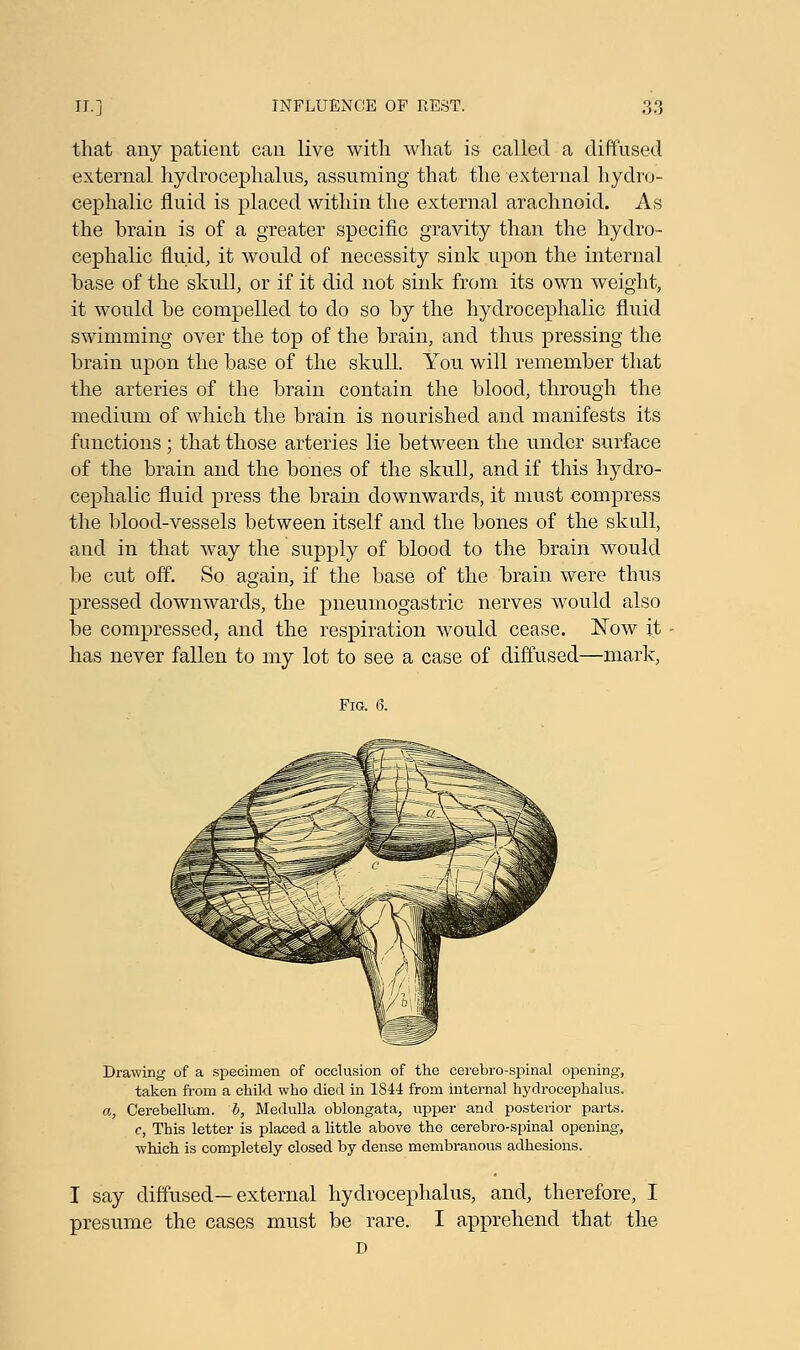 that any patient can live witli what is called a diffused external hydrocephalus, assuming that the external hydro- cephalic fluid is placed within the external arachnoid. As the brain is of a greater specific gravity than the hydro- cephalic fluid, it would of necessity sink upon the internal base of the skull, or if it did not sink from its own weight, it would be compelled to do so by the hydrocephalic fluid swimming over the top of the brain, and thus pressing the brain upon the base of the skull. You will remember that the arteries of the brain contain the blood, through the medium of which the brain is nourished and manifests its functions ; that those arteries lie between the under surface of the brain and the bones of the skull, and if this hydro- cephalic fluid press the brain downwards, it must compress the blood-vessels between itself and the bones of the skull, and in that way the supply of blood to the brain would be cut off. So again, if the base of the brain were thus pressed downwards, the pneumogastric nerves would also be compressed, and the respiration would cease. Now it has never fallen to my lot to see a case of diffused—mark, Fig. 6. Drawing of a specimen of occlusion of the cerebro-spinal opening, taken from a child who died in 1844 from internal hydrocephalus. a, Cerebellum, b, Medulla oblongata, upper and posterior parts, c, This letter is placed a little above the cerebro-spinal opening, ■which is completely closed by dense membranous adhesions. I say diffused—external hydrocephalus, and, therefore, I presume the cases must be rare. I apprehend that the D