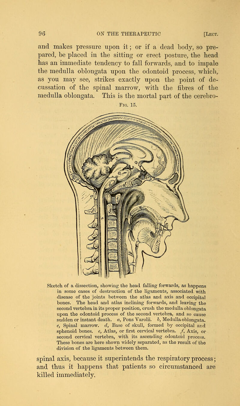 and makes pressure upon it; or if a dead body, so pre- pared, be placed in the sitting or erect posture, the head has an immediate tendency to fall forwards, and to impale the medulla oblongata upon the odontoid process, which, as you may see, strikes exactly upon the point of de- cussation of the spinal marrow, with the fibres of the medulla oblongata. This is the mortal part of the cerebro- Fig. 15. Sketch of a dissection, showing the head falling forwards, as happens in some cases of destruction of the ligaments, associated with disease of the joints between the atlas and axis and occipital bones. The head and atlas inclining forwards, and leaving the second vertebra in its proper position, crush the medulla oblongata upon the odontoid process of the second vertebra, and so cause sudden or instant death. «, Pons Varolii, b, Medulla oblongata. c, Spinal marrow, cl, Base of skull, formed by occipital and sphenoid bones, e, Atlas, or first cervical vertebra. /, Axis, or second cervical vertebra, with its ascending odontoid process. These bones are here shown widely separated, as the result of the division of the ligaments between them. spinal axis, because it superintends the respiratory process; and thus it happens that patients so circumstanced are killed immediately.